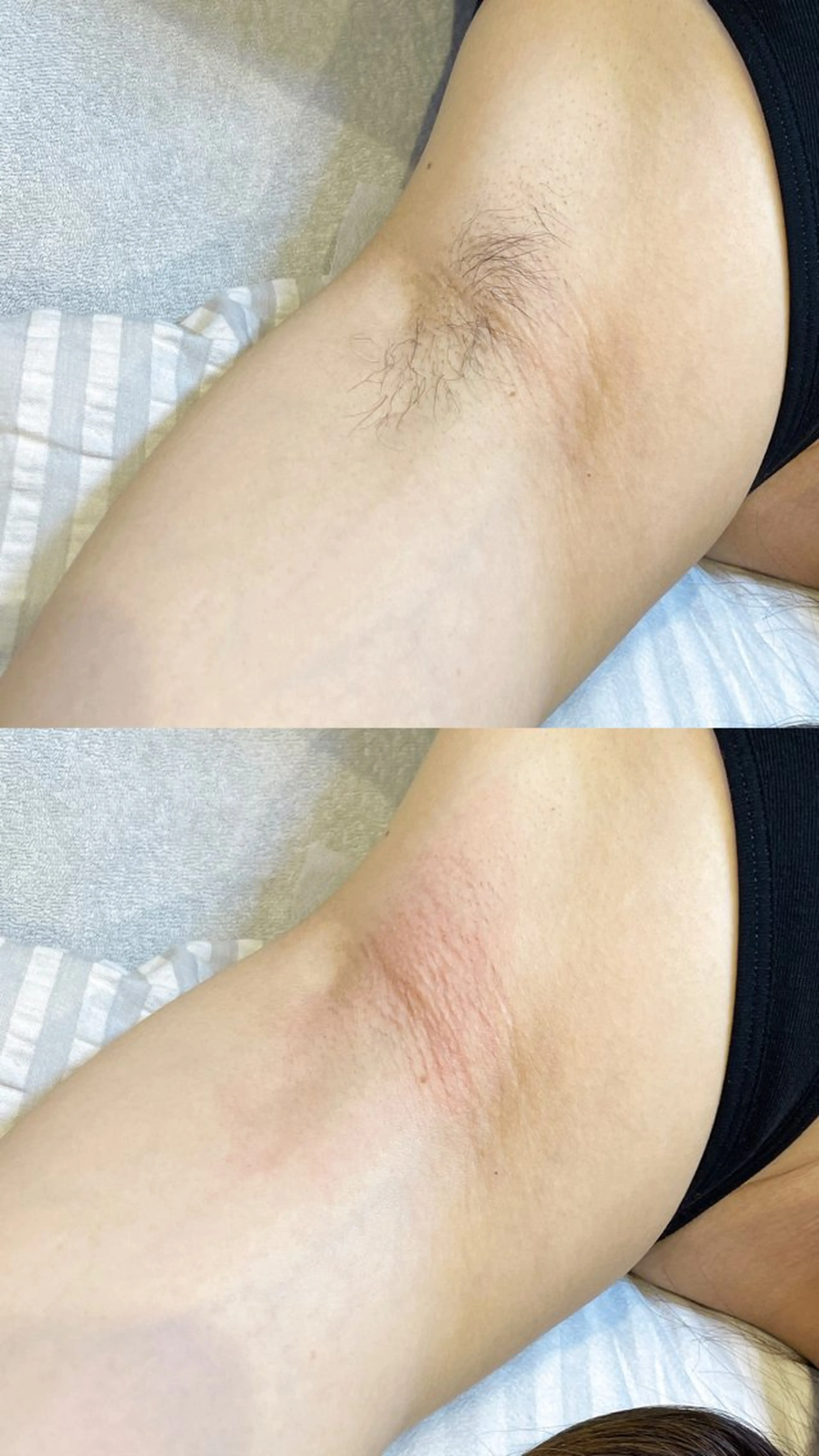 VIO脱毛専門店 kika〜キカ〜所属・【メンズSTART】 VIO専門店kikaのエステ・リラクイメージ