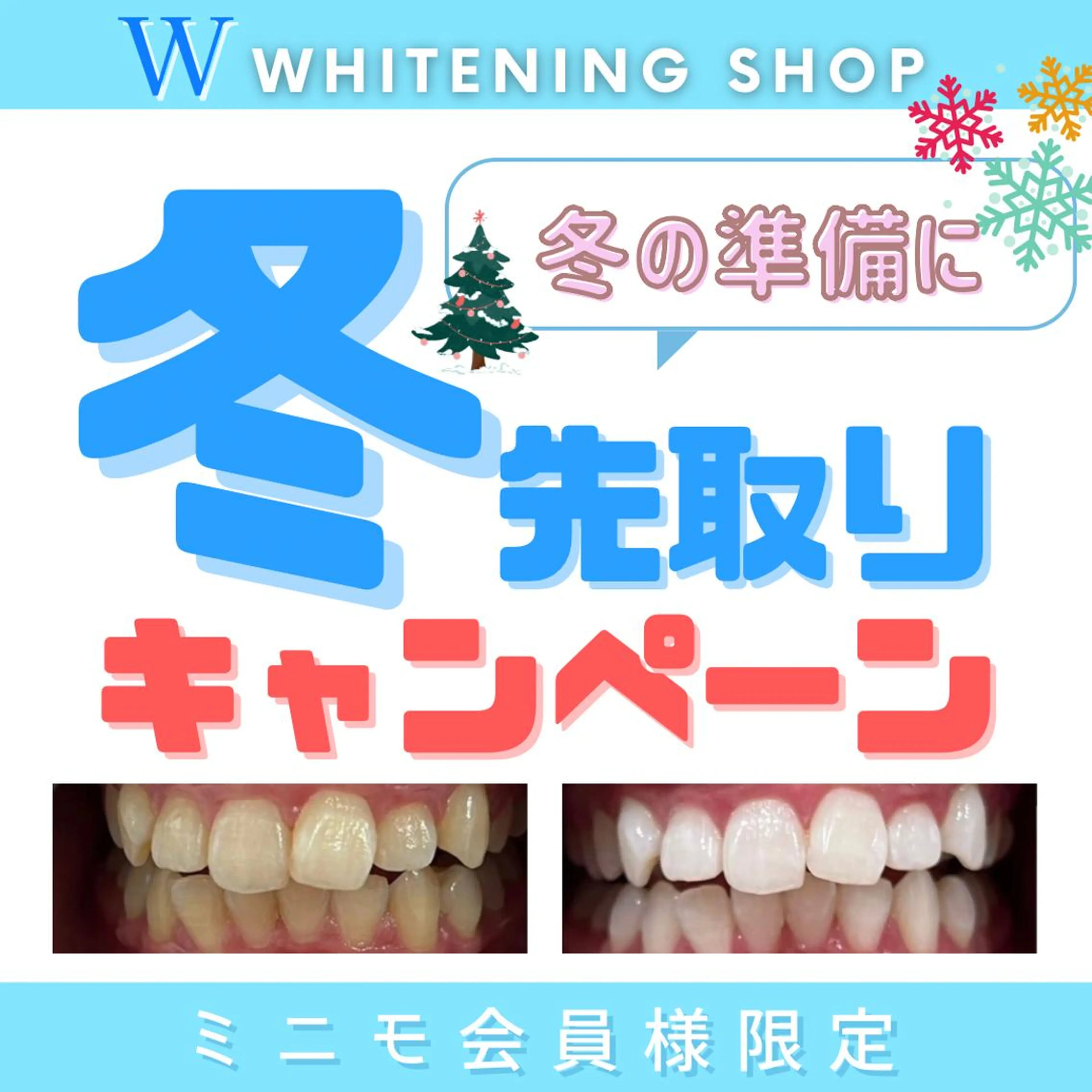 メンズ その他 ホワイトニング ショップ新小岩店のその他イメージ