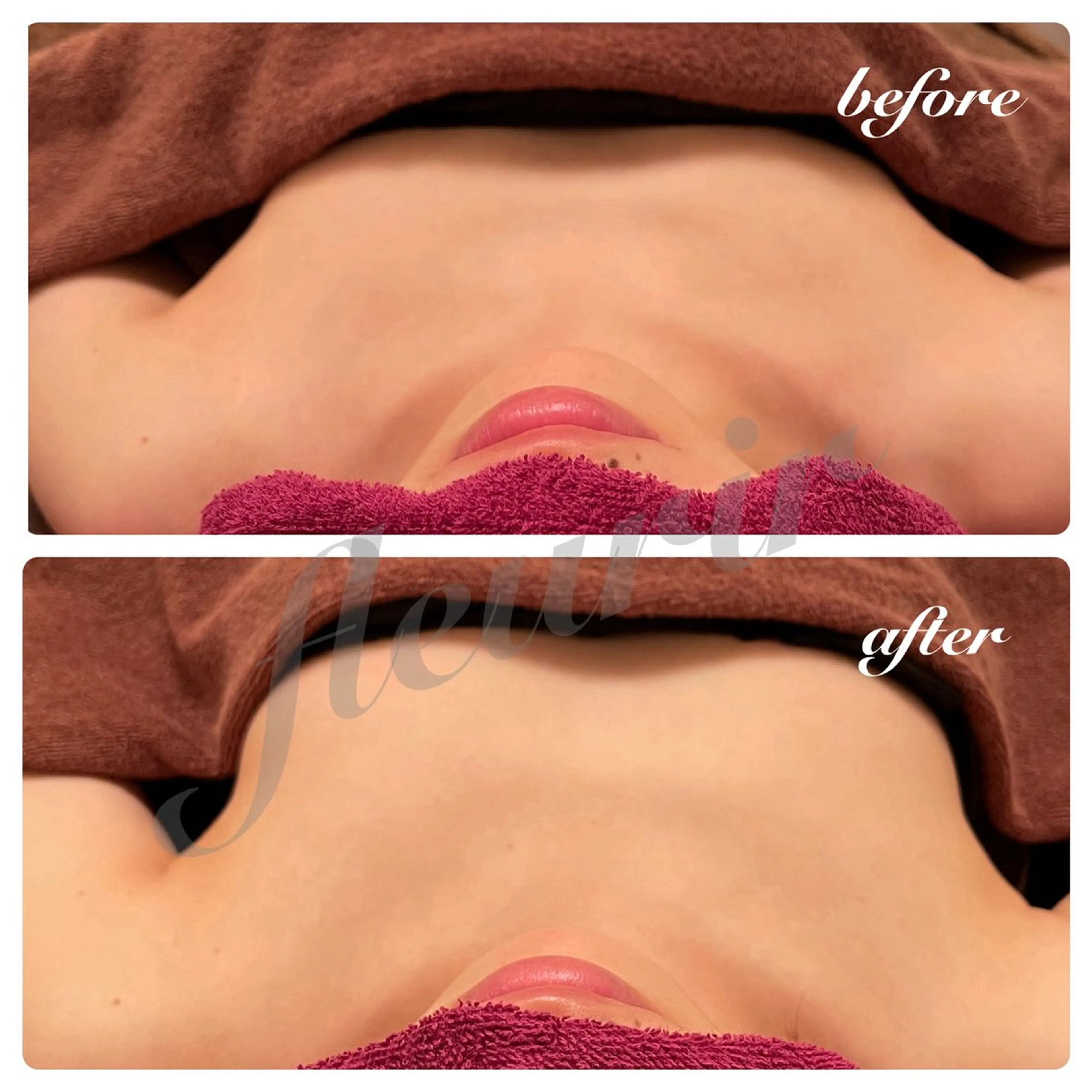 バストケア70分(下垂バストを持ち上げる)の写真