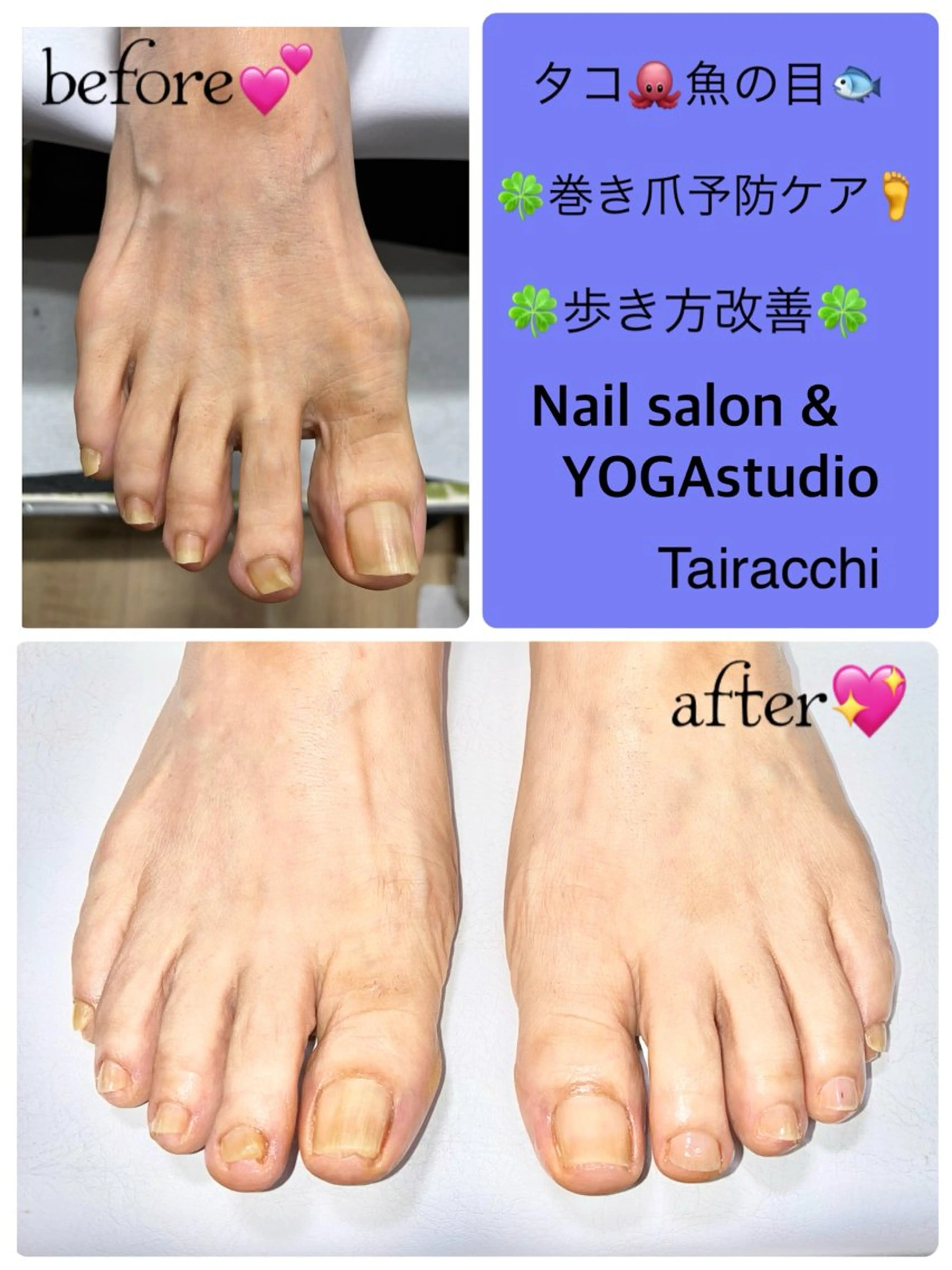 ネイル フットネイル Tairacchi ﾀｲﾗｯﾁのネイルデザイン
