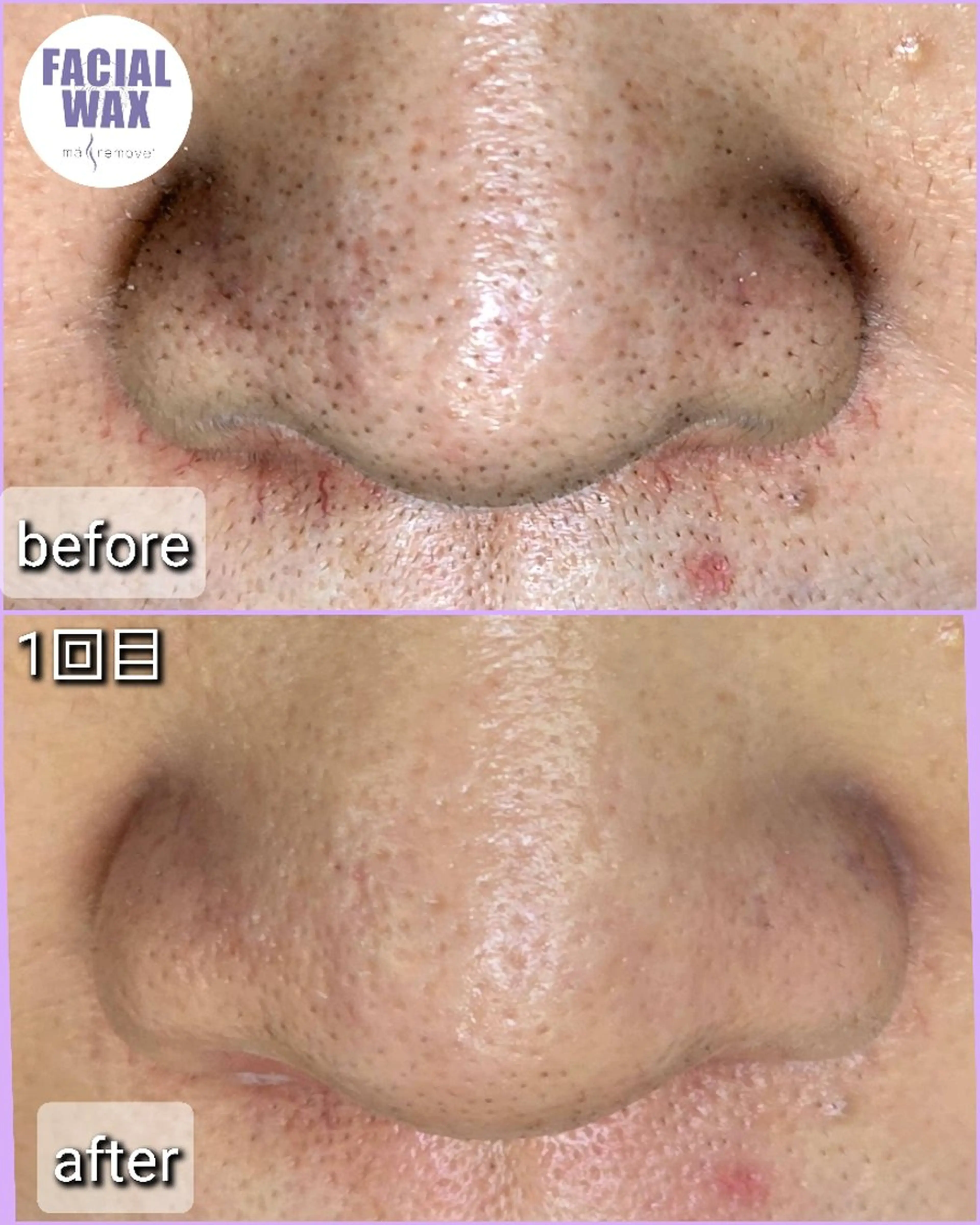 エステ facial salon Lily所属・salon Lilyのエステ・リラクイメージ