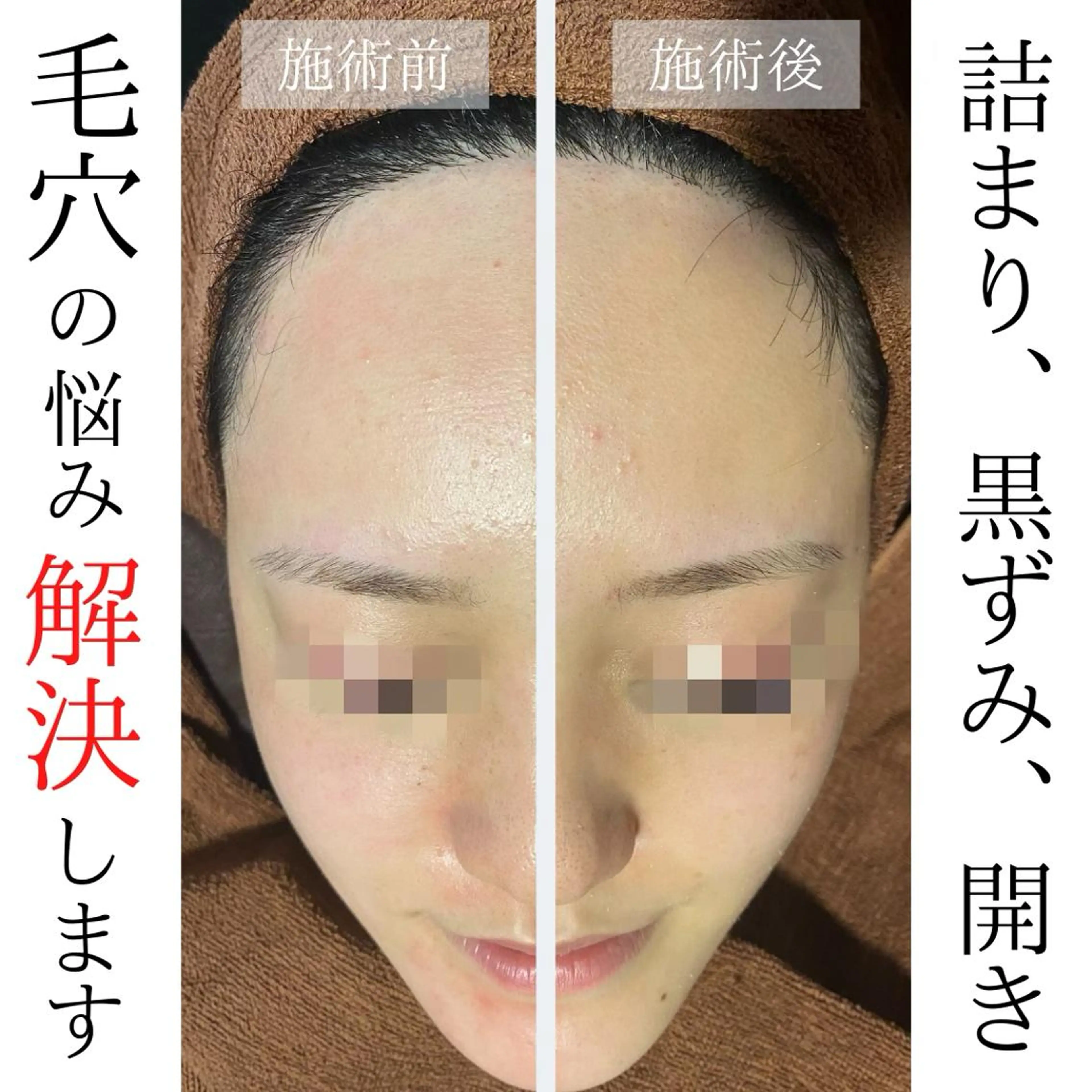 ハーブピーリング・毛穴ケア専門サロンSalon de LENA所属・ハーブピーリング 専門店/名古屋駅前店のエステ・リラクイメージ
