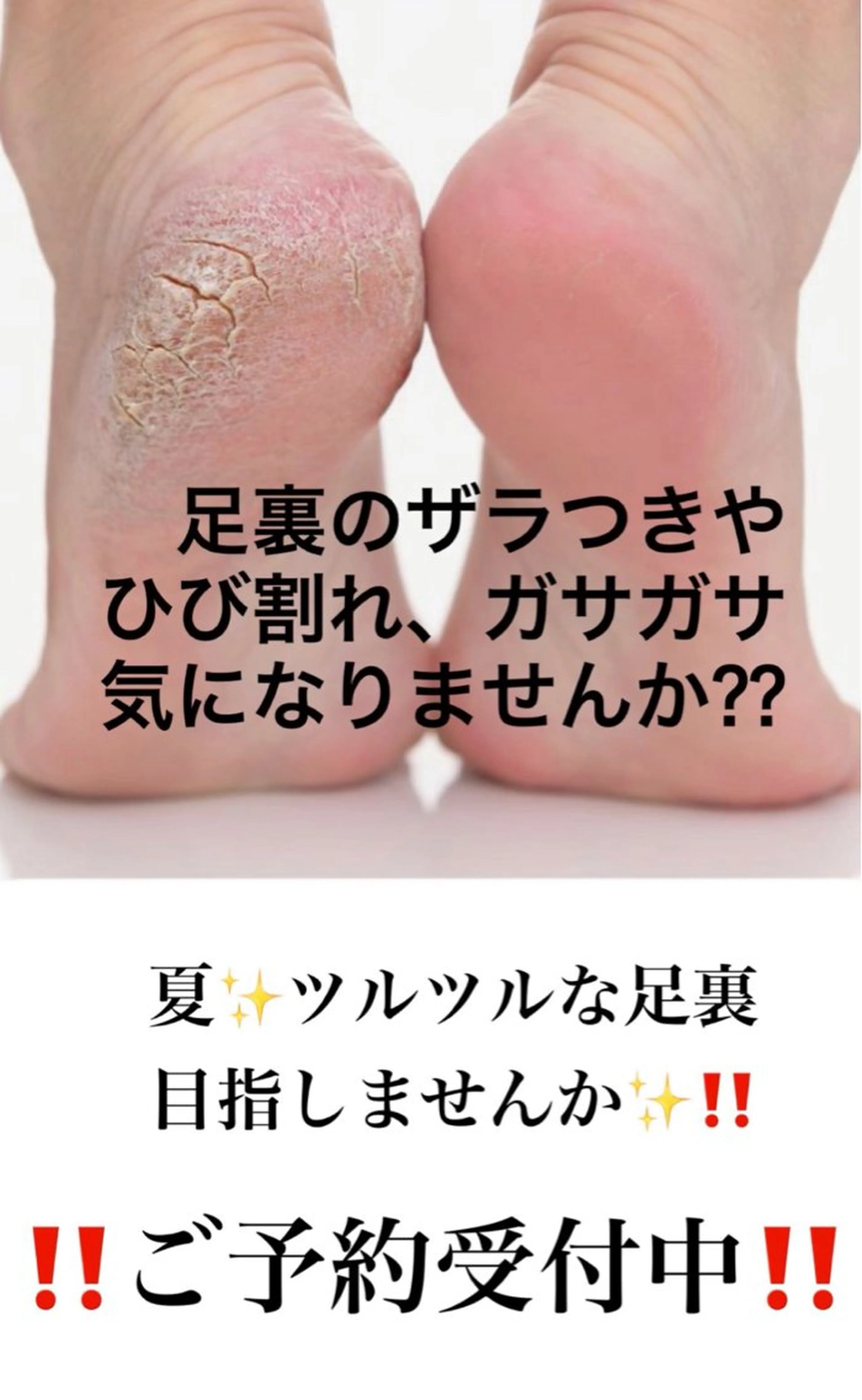 角質ケア＋フットマッサージの写真