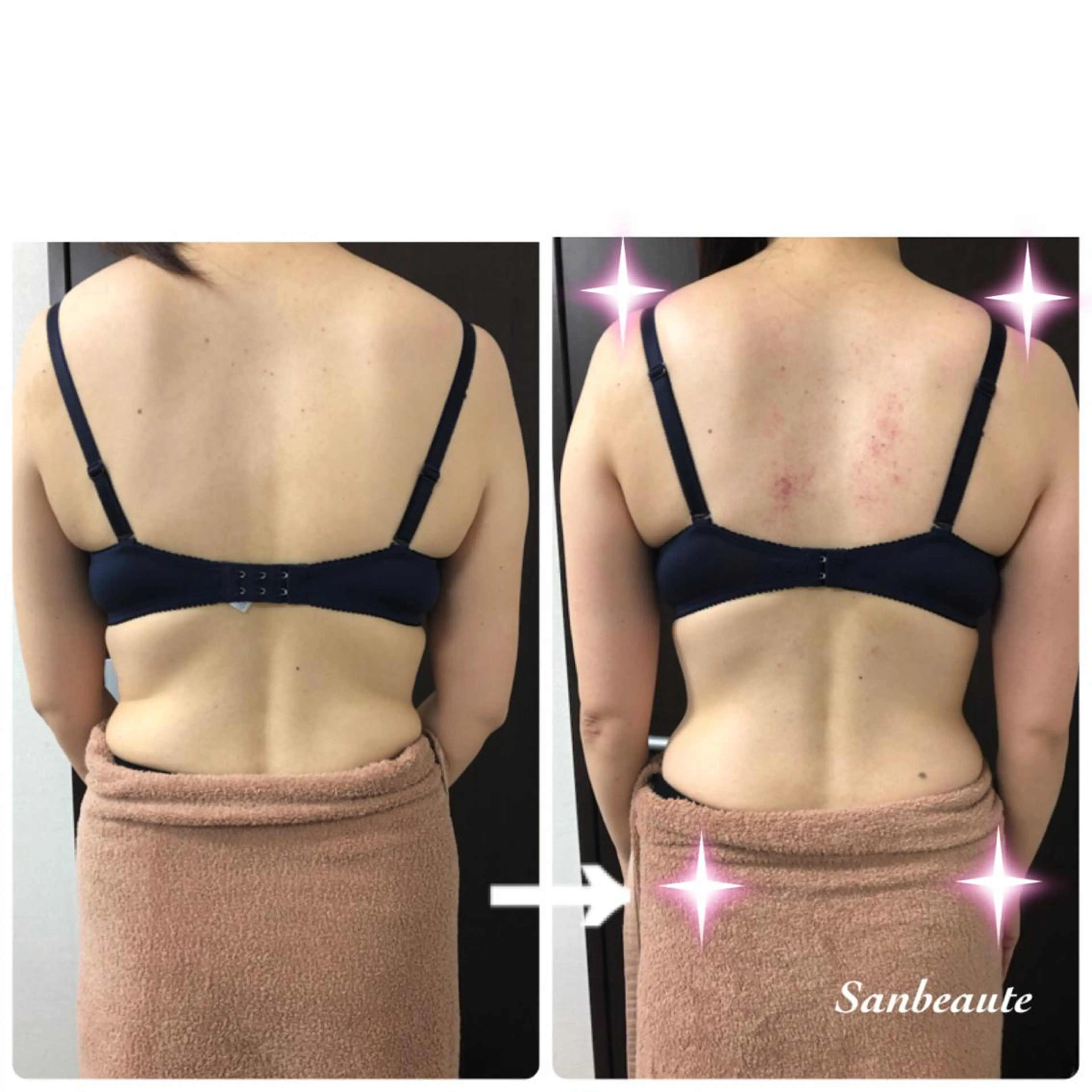 エステ Sanbeaute サンボーテのエステ・リラクイメージ
