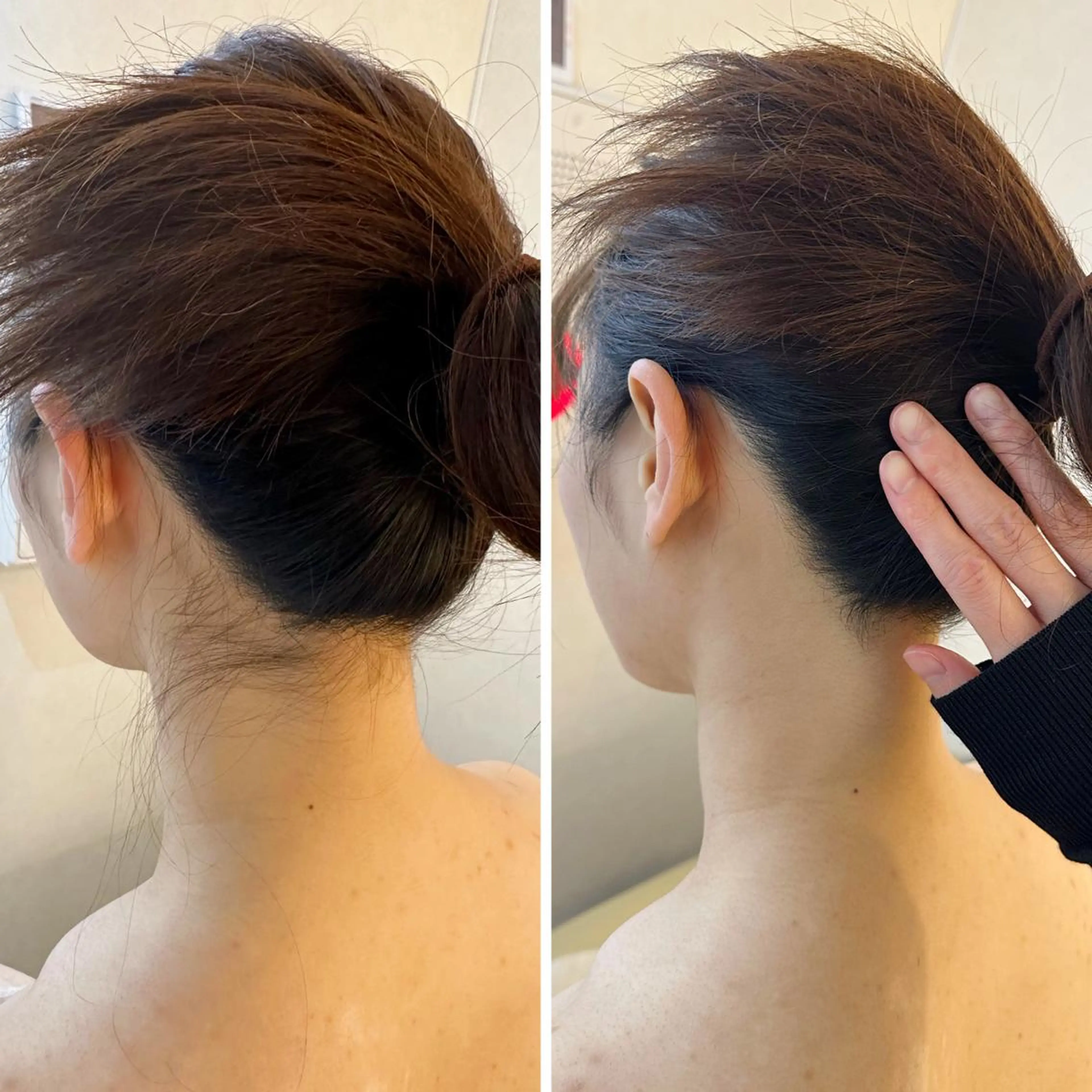 脱毛 うなじ脱毛/美肌脱毛 LABELのエステ・リラクイメージ