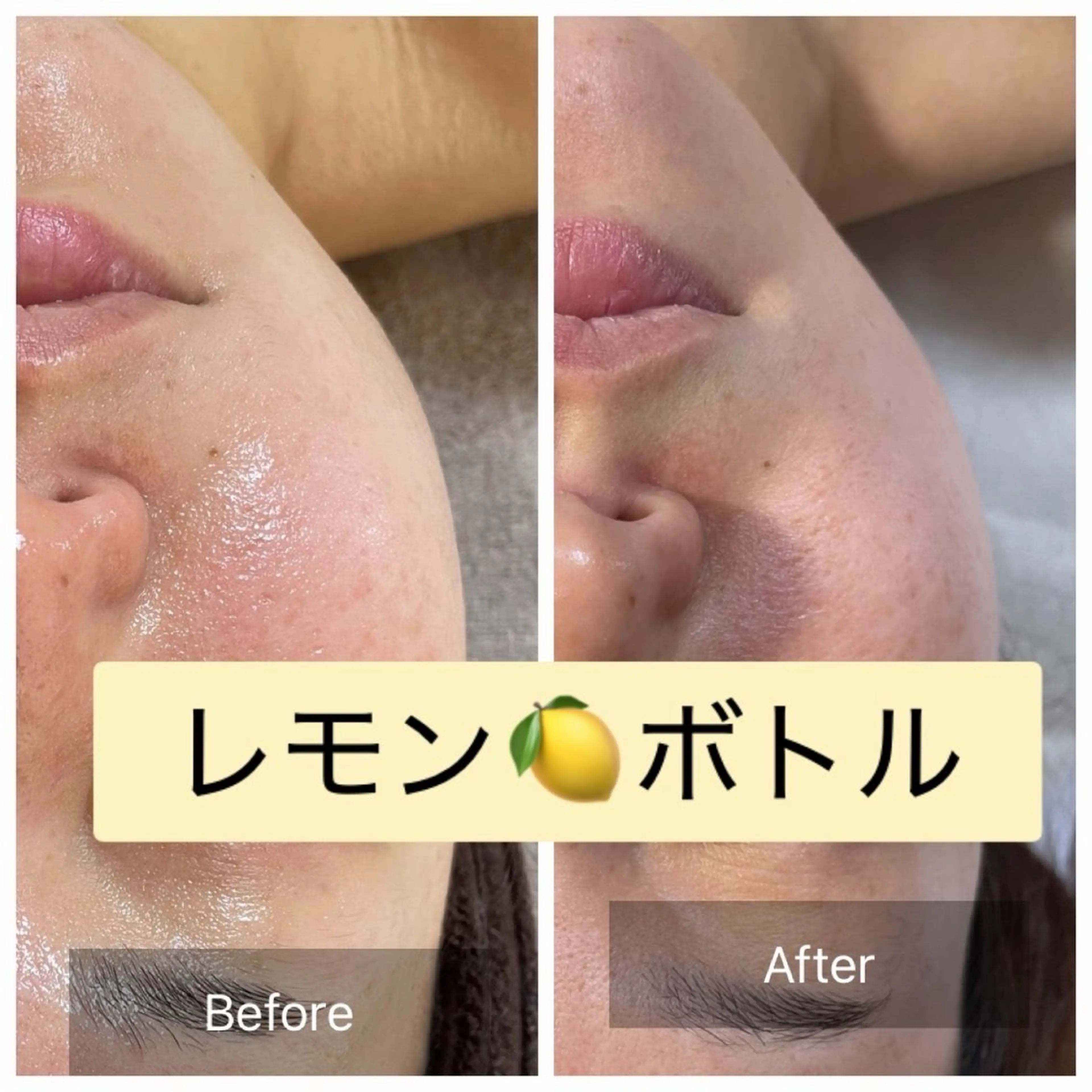 レモン🍋ボトル　　韓国発　スッキリ小顔の写真