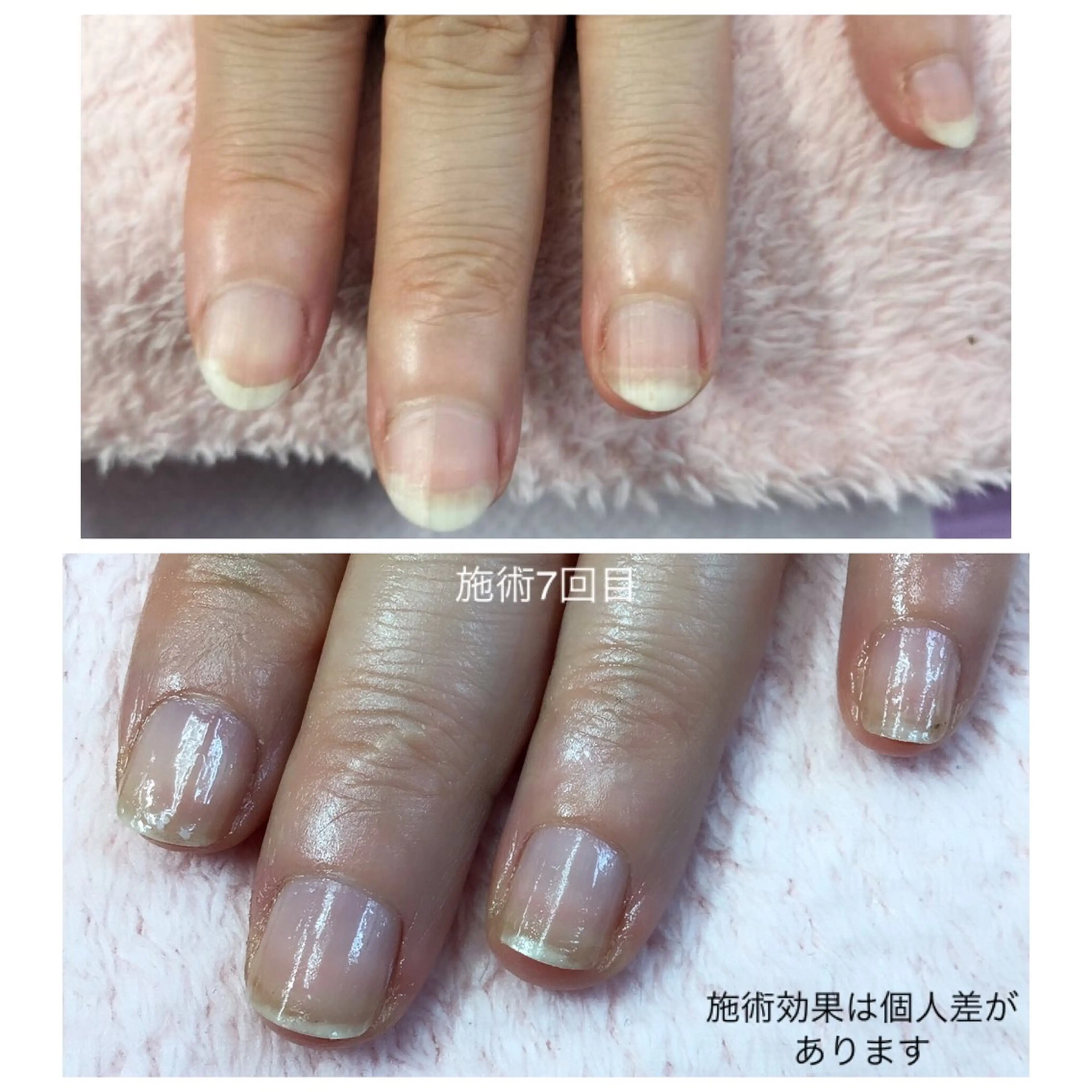 ハンドケア e.nail所属・和賀井 恵理のネイルデザイン