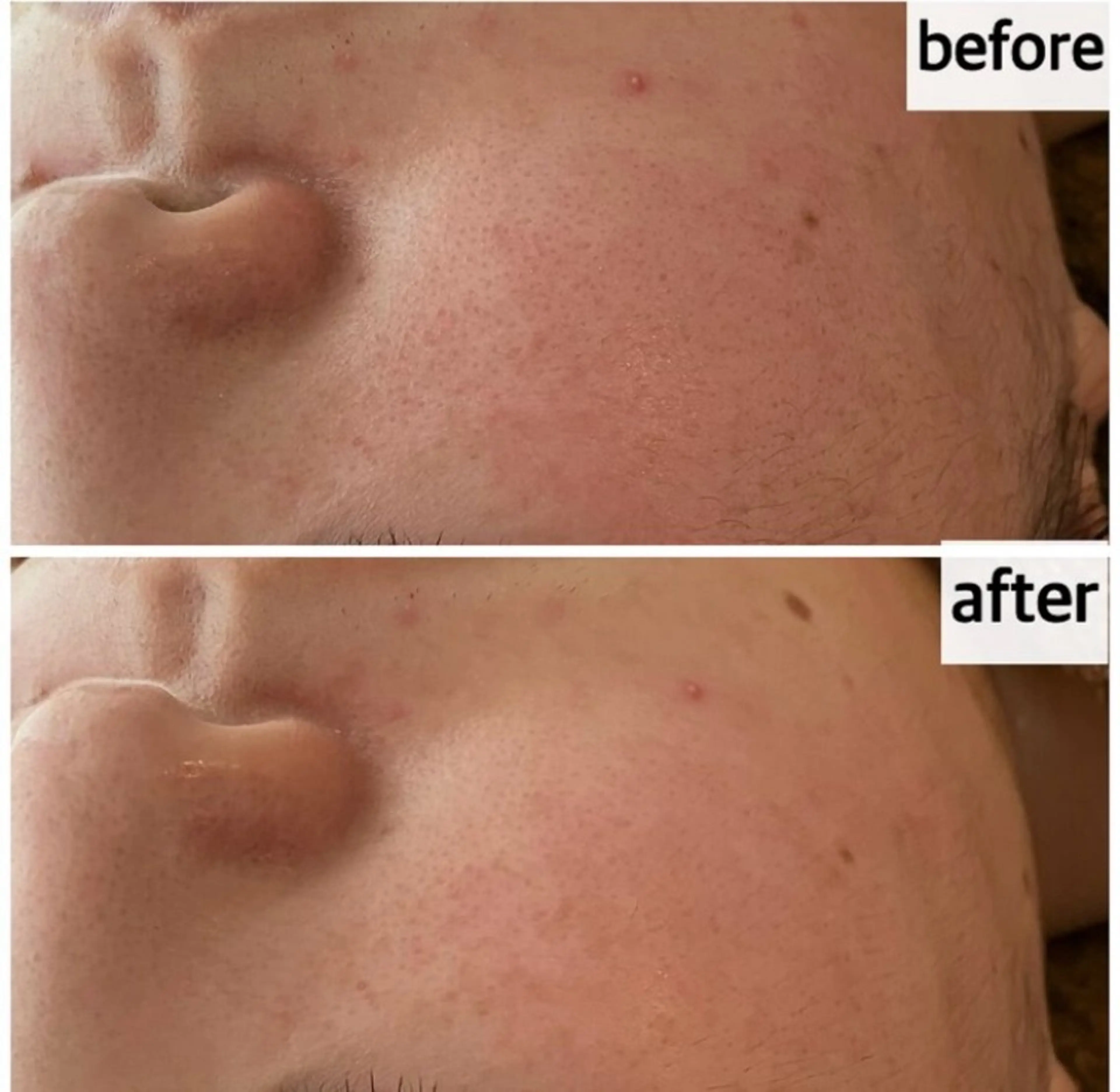 エステ メナード岐阜茜部 杉浦のエステ・リラクイメージ