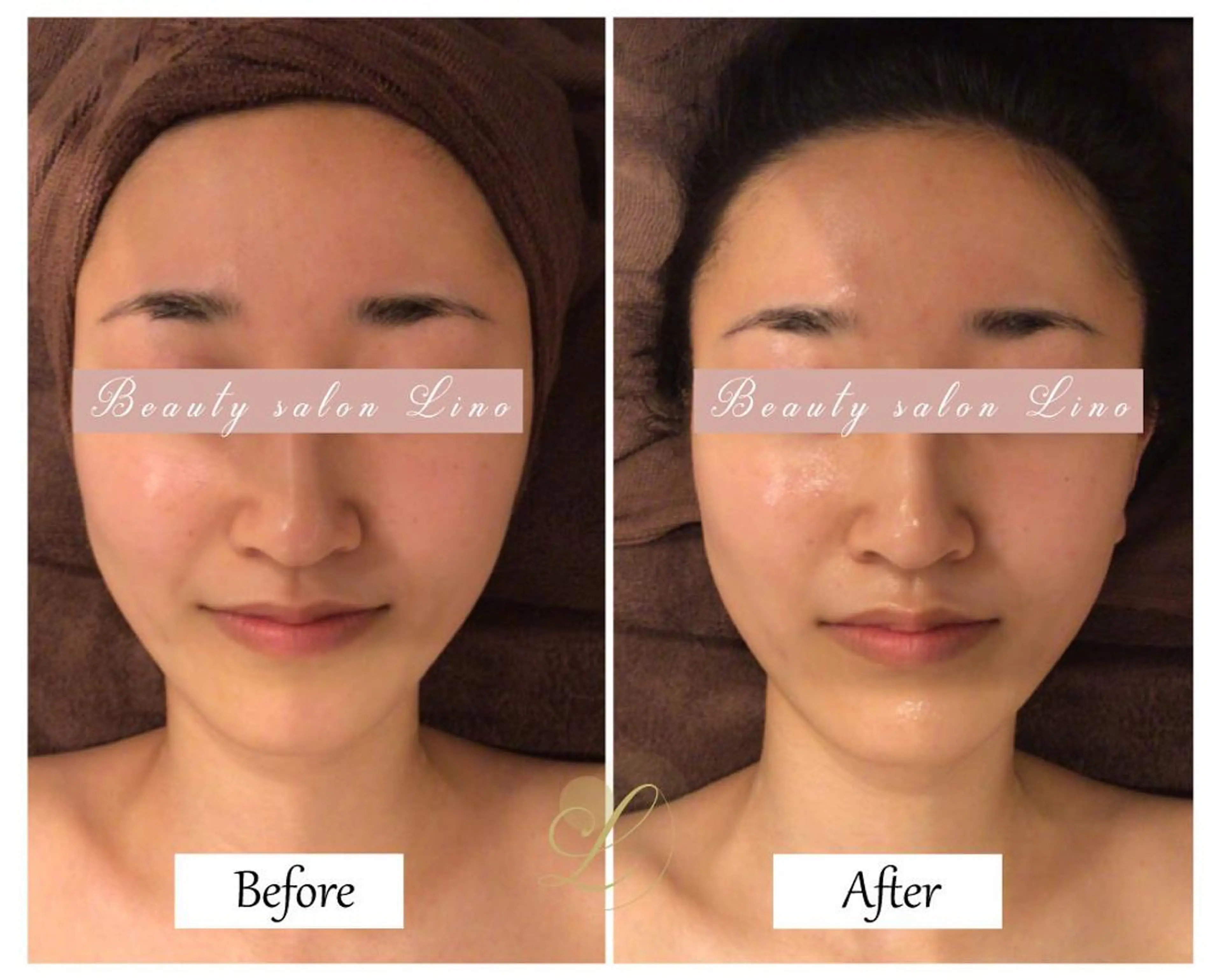 痩身×フェイシャル ブライダル|Linoのエステ・リラクイメージ