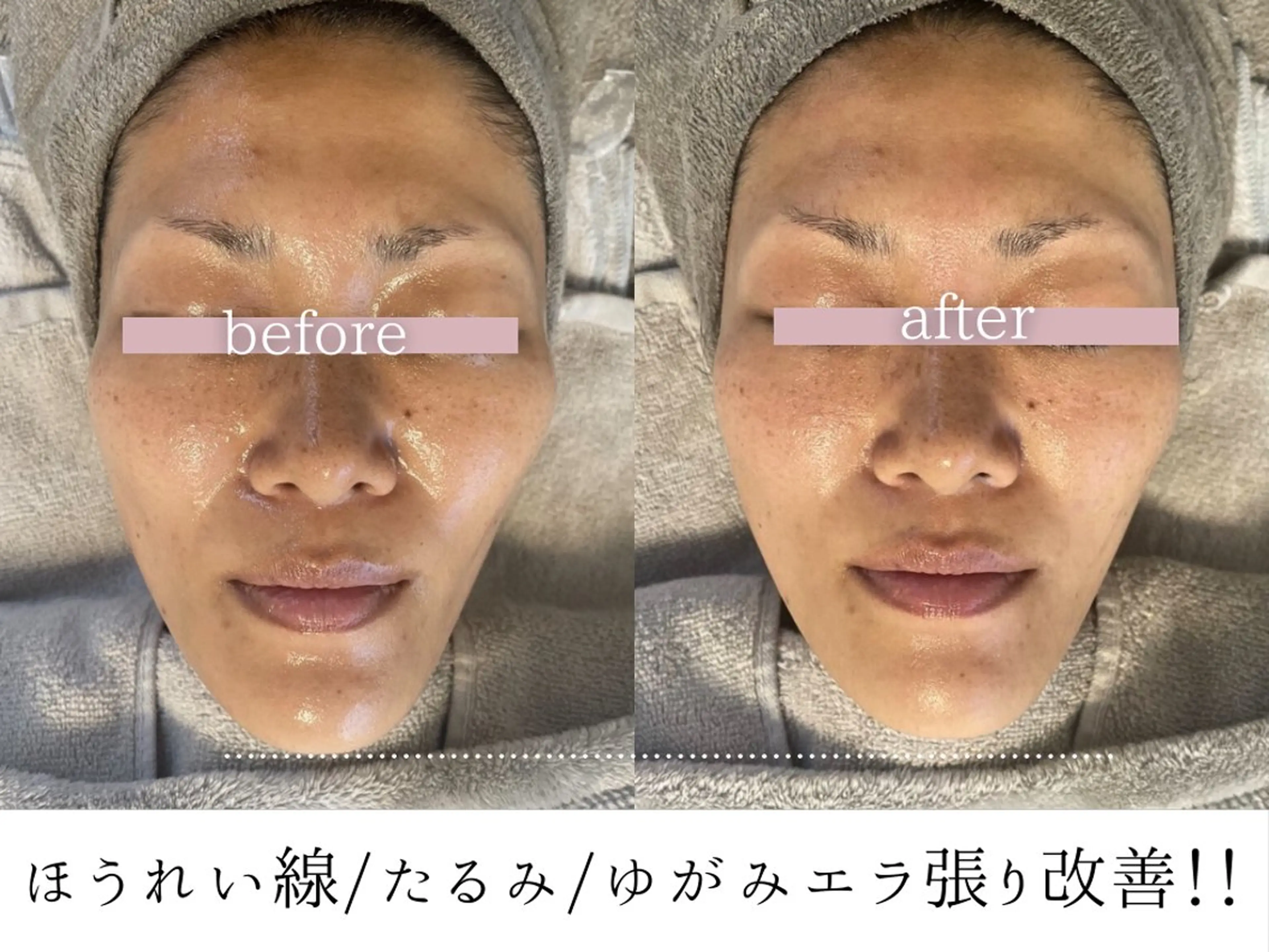 頭蓋骨小顔コルギPerm所属・頭蓋骨小顔コルギ Permのその他イメージ