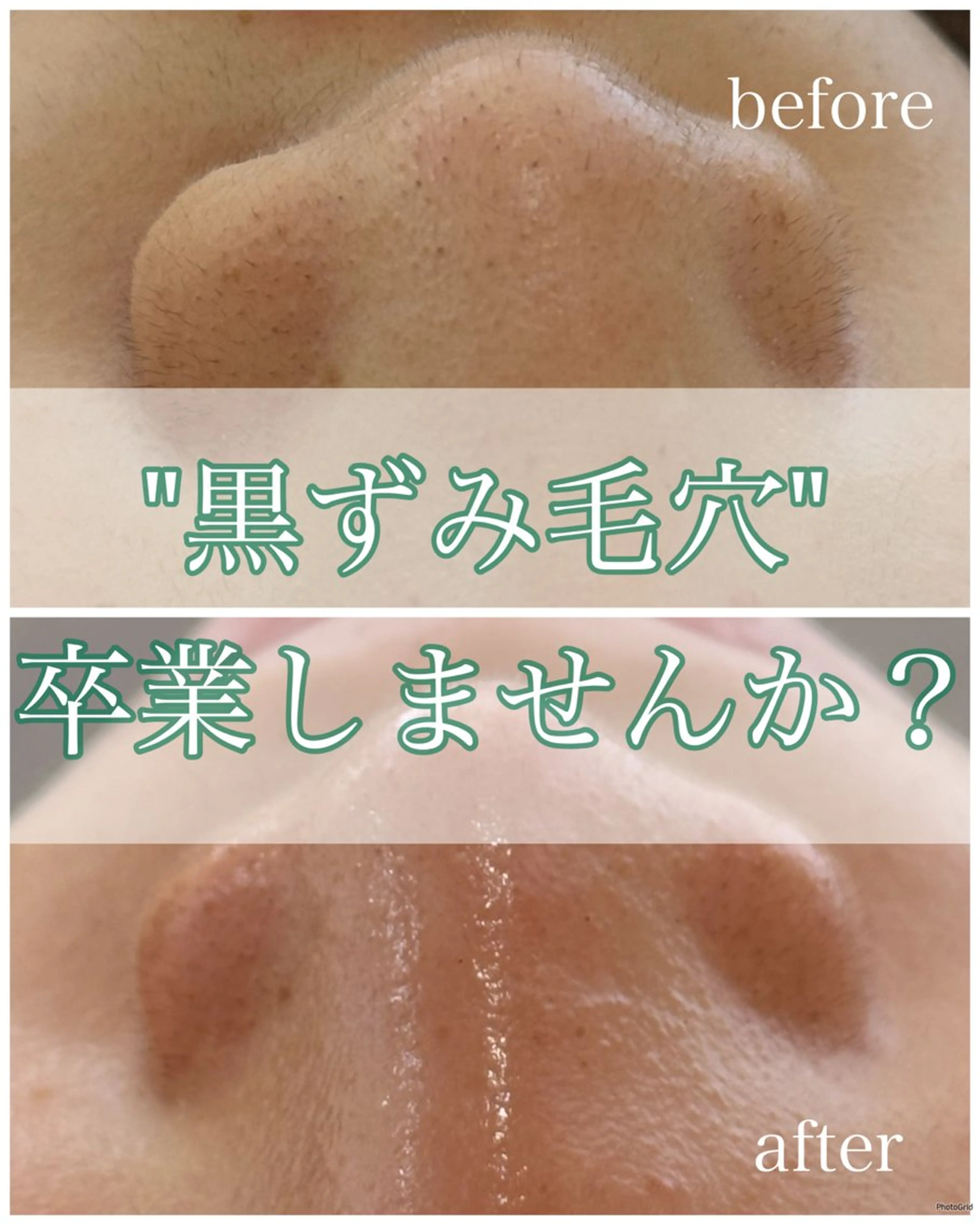 エステ écla【中崎町】 yukikoのエステ・リラクイメージ