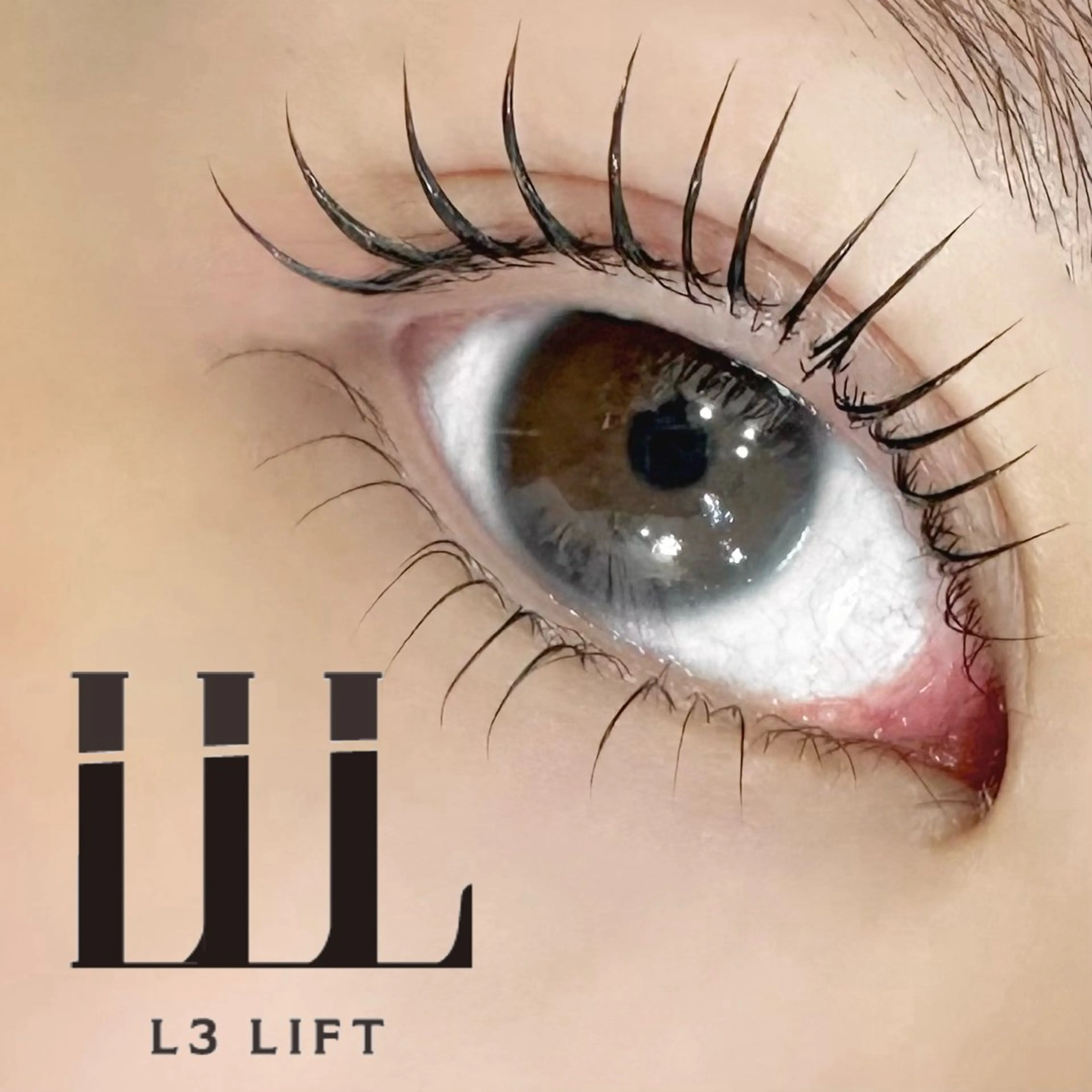 L3リフトの写真