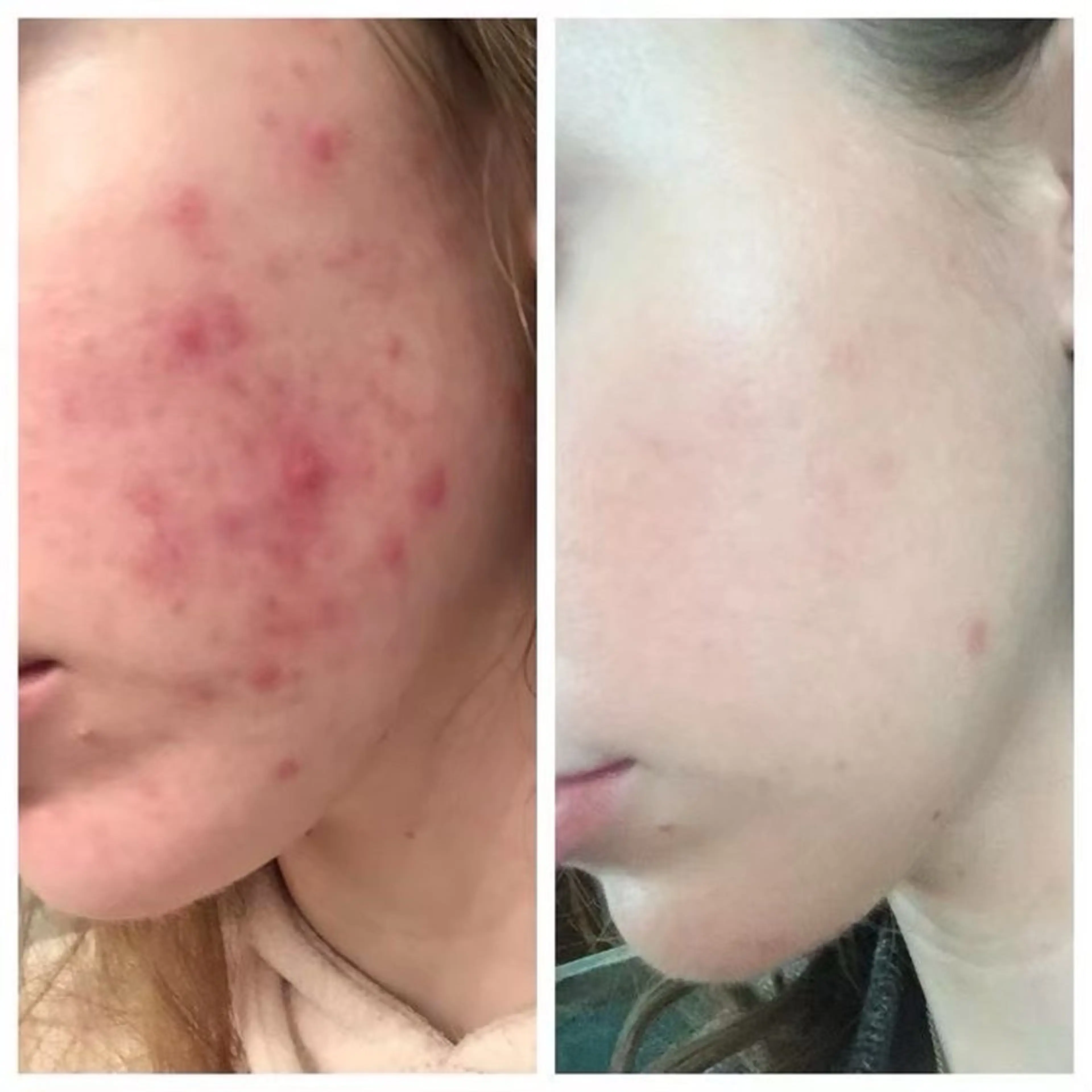 siro スタッフのエステ・リラクイメージ