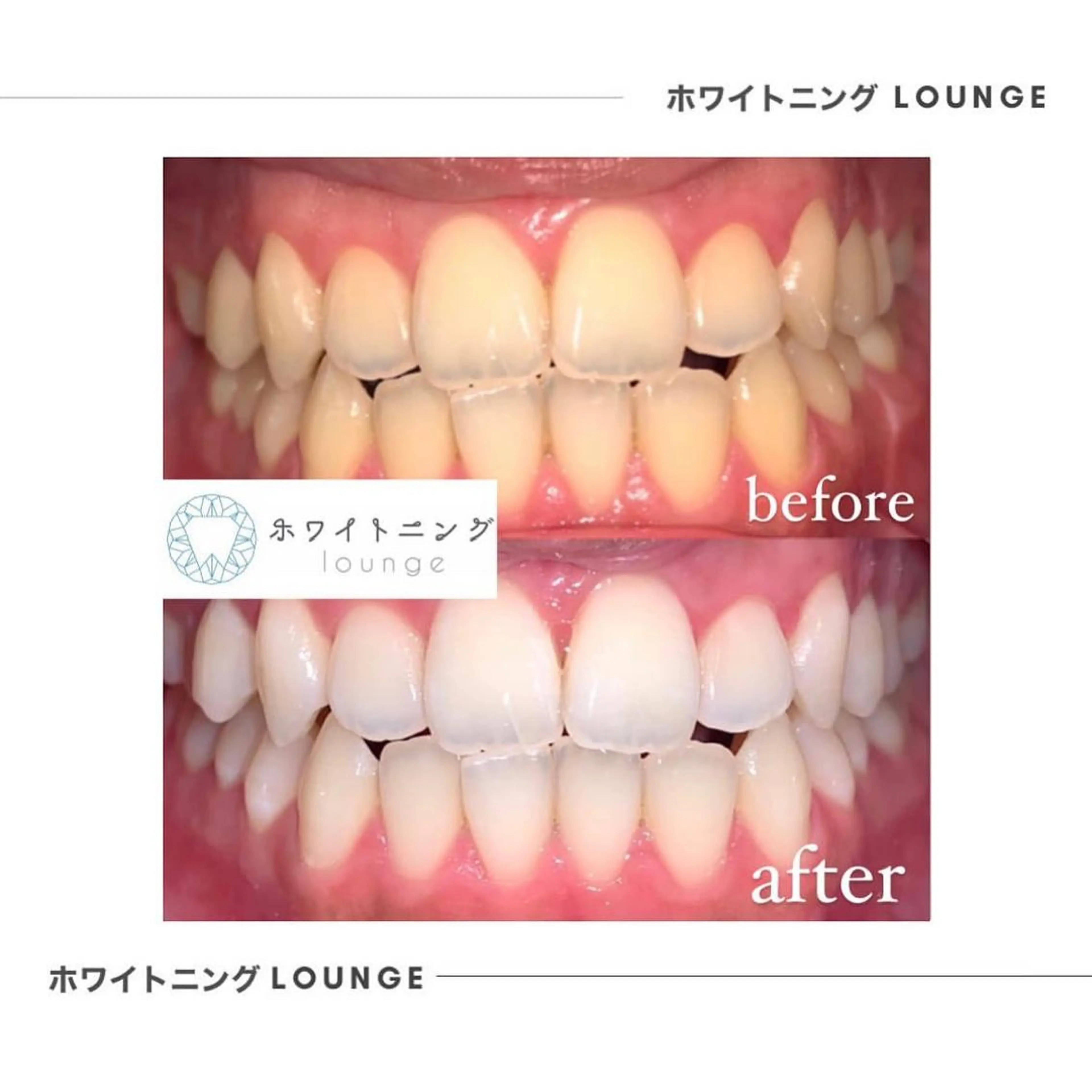 ホワイトニングラウンジ横須賀所属・ホワイトニング Lounge横須賀のその他イメージ