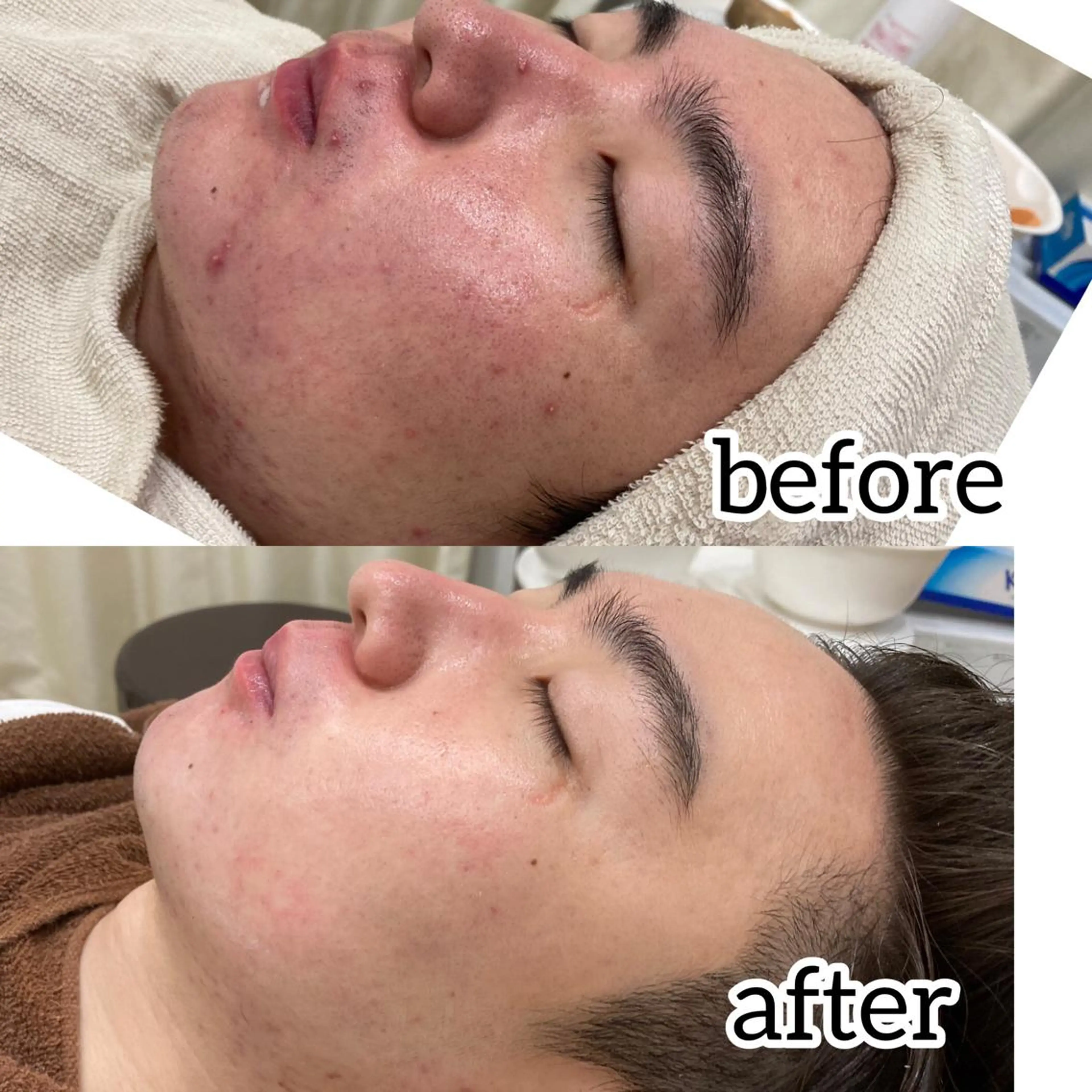 laluna saki...のその他イメージ