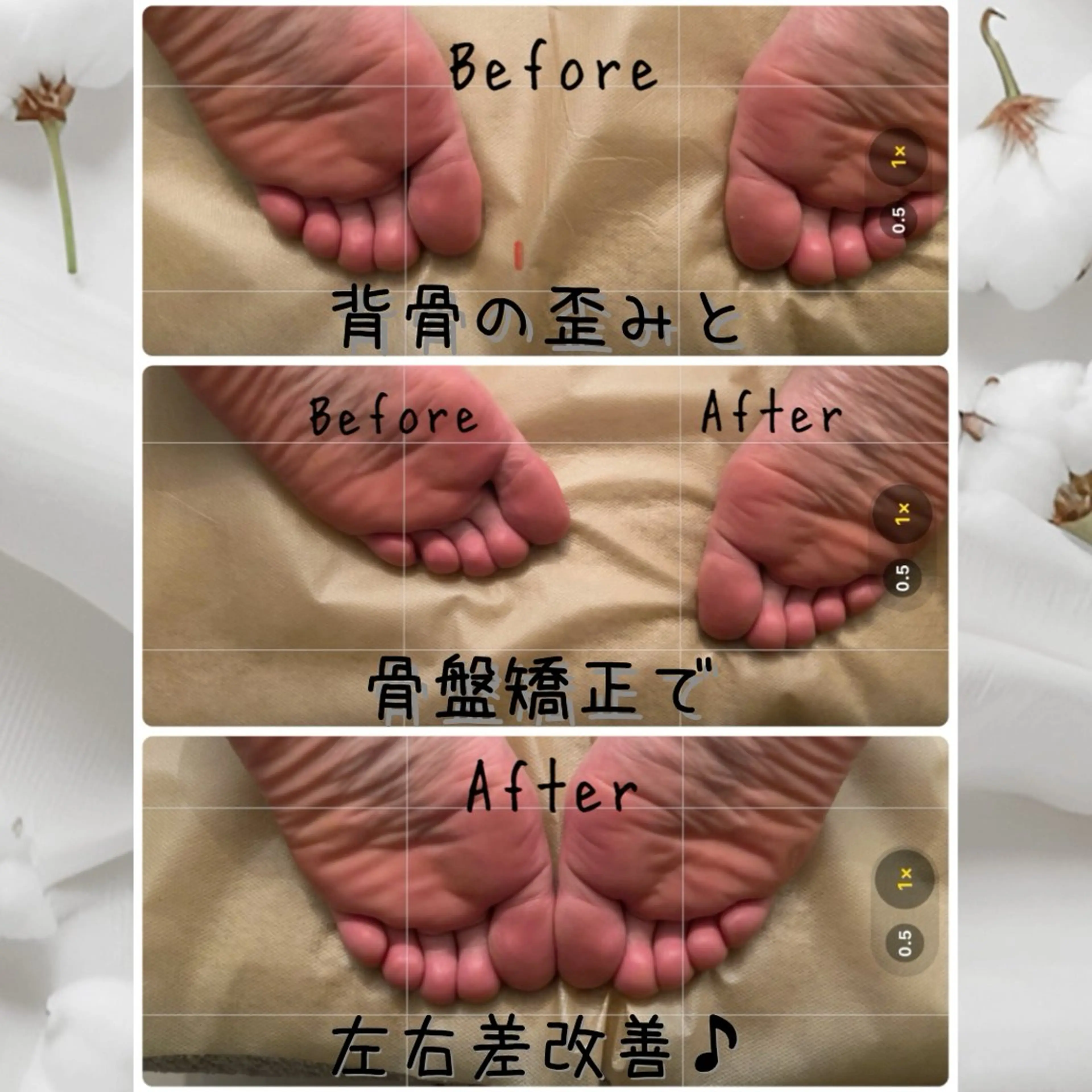 【🧍‍♀️パンパン足腰/腰痛改善に🧍‍♂️】背骨/骨盤矯正＋アロマリンパマッサージ120分の写真