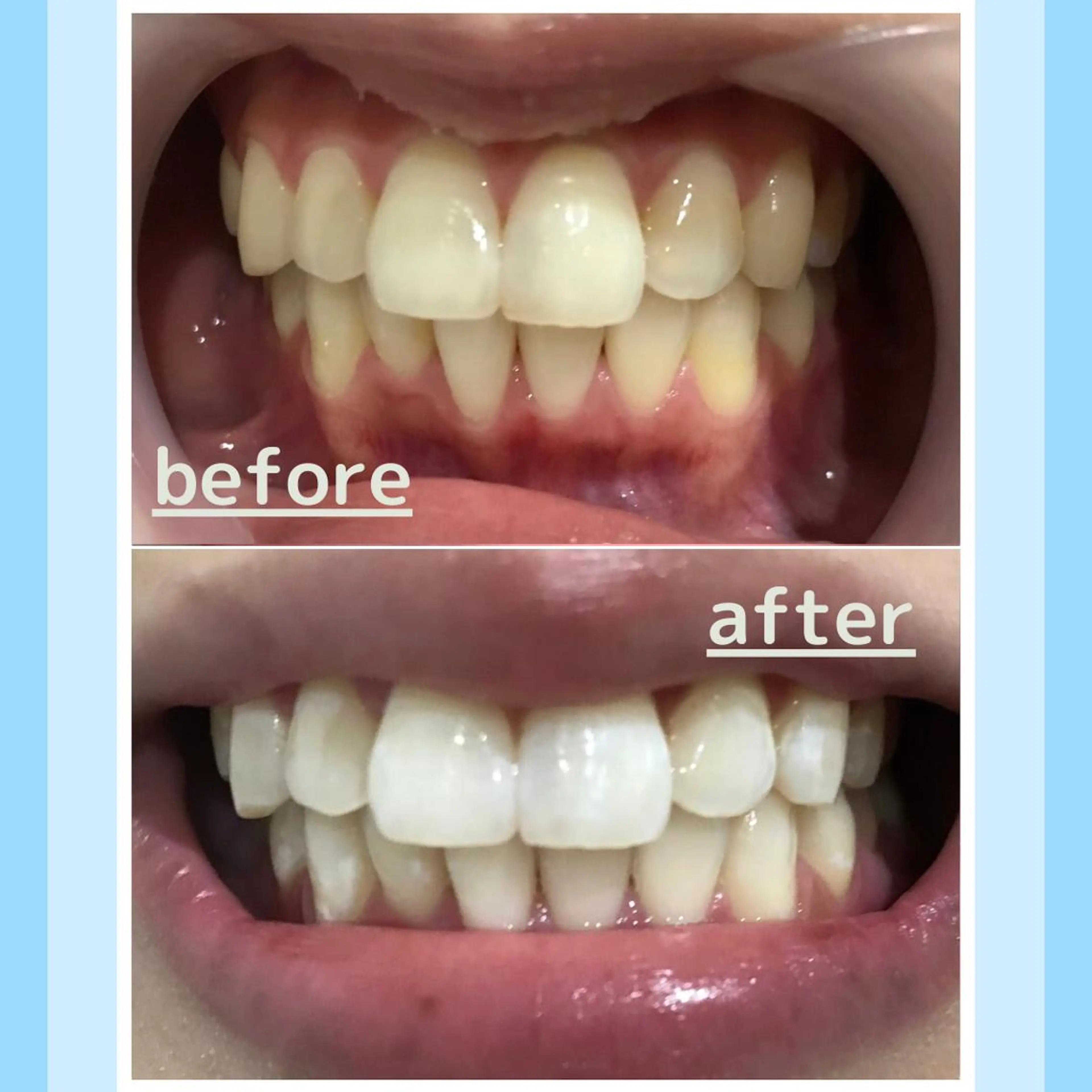 メンズ その他 お手軽ホワイトニングsalon mina所属・武元 奈津美のその他イメージ