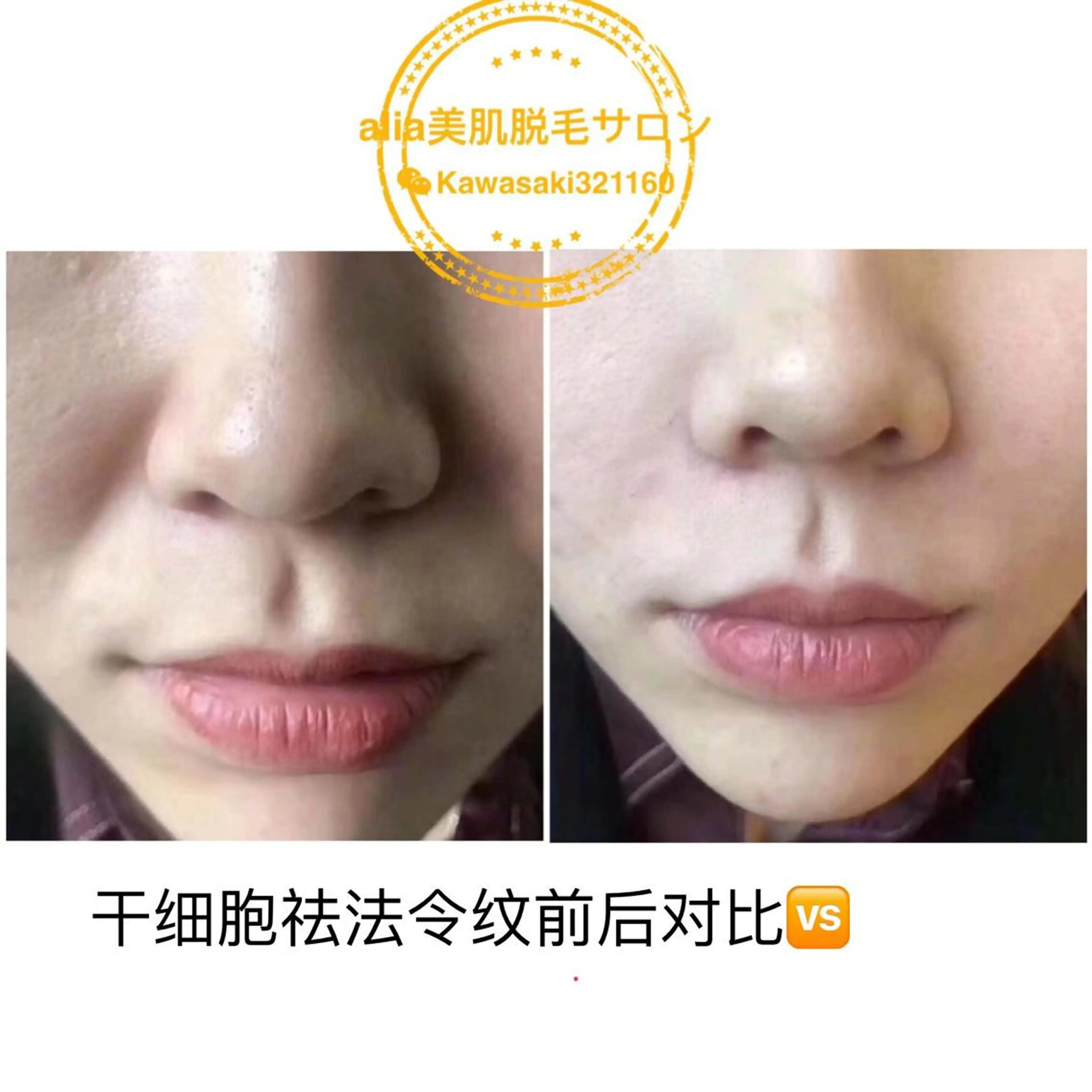 aliaハイフ&水光ジェットサロン所属・aliaハーブ水光店 エステティシャン募集のエステ・リラクイメージ