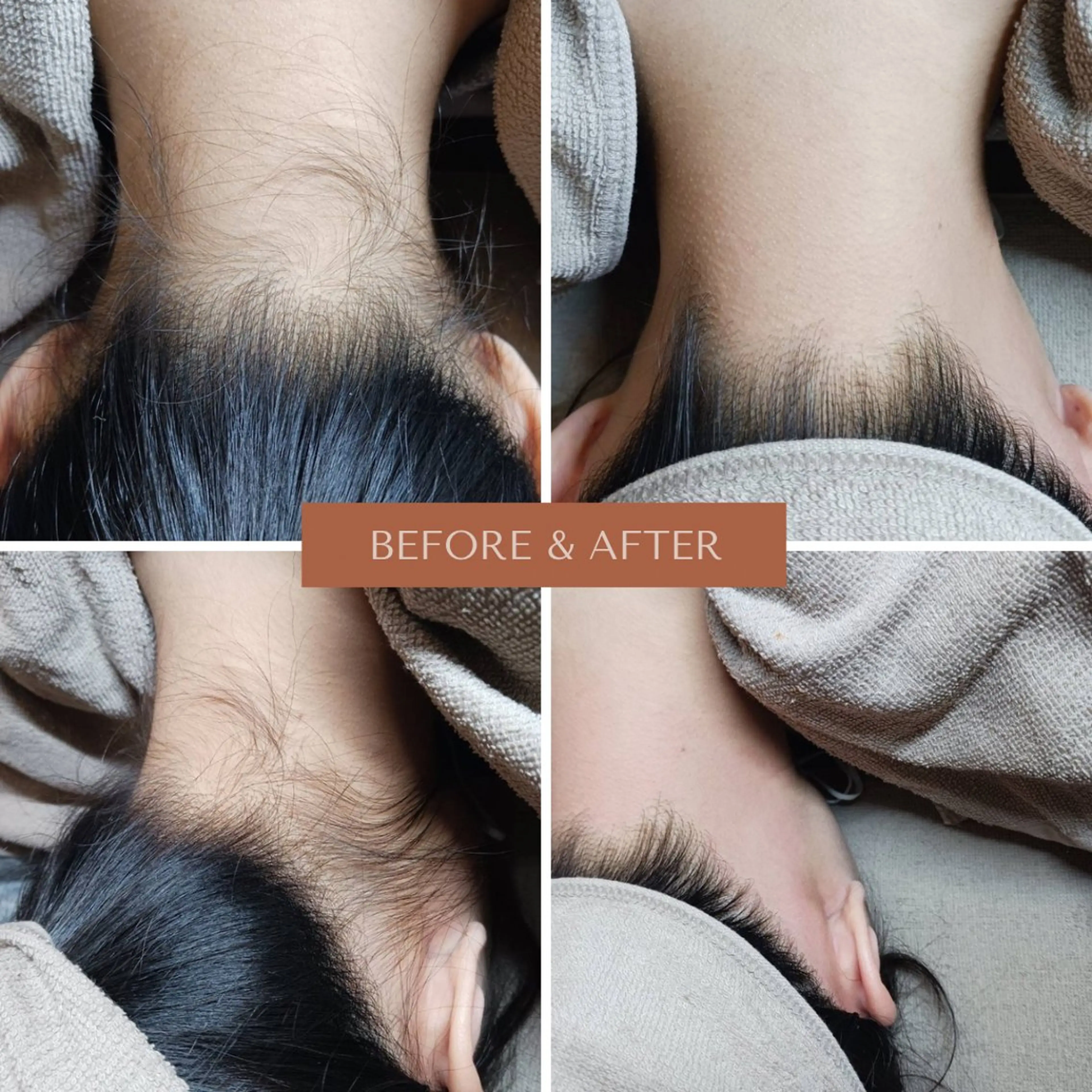 【人気💫】前日でも間に合う‼️うなじ美人WAX脱毛👘浴衣・アップヘアにおすすめ♪の写真