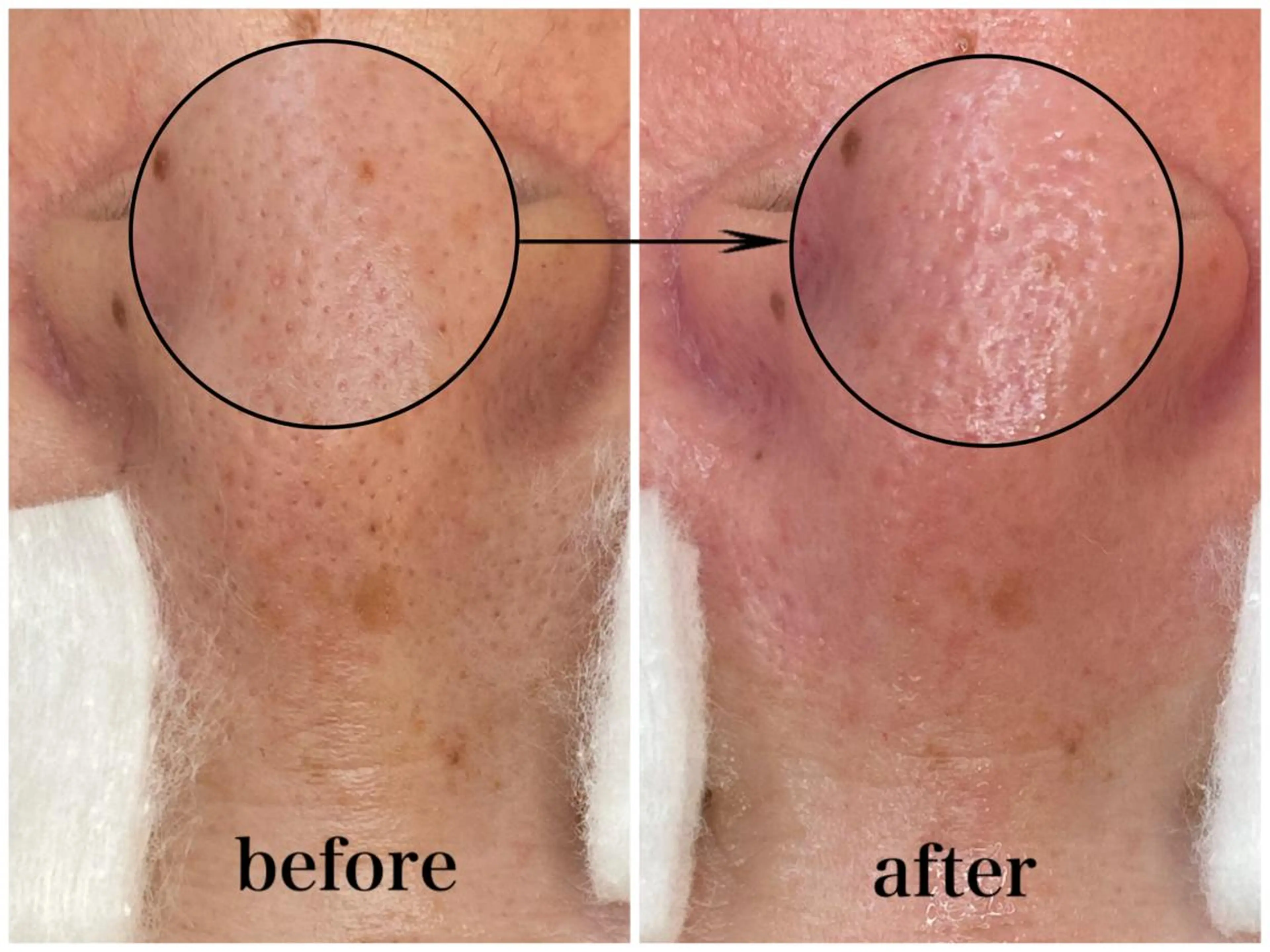 韓国肌管理 【毛穴専科】のエステ・リラクイメージ