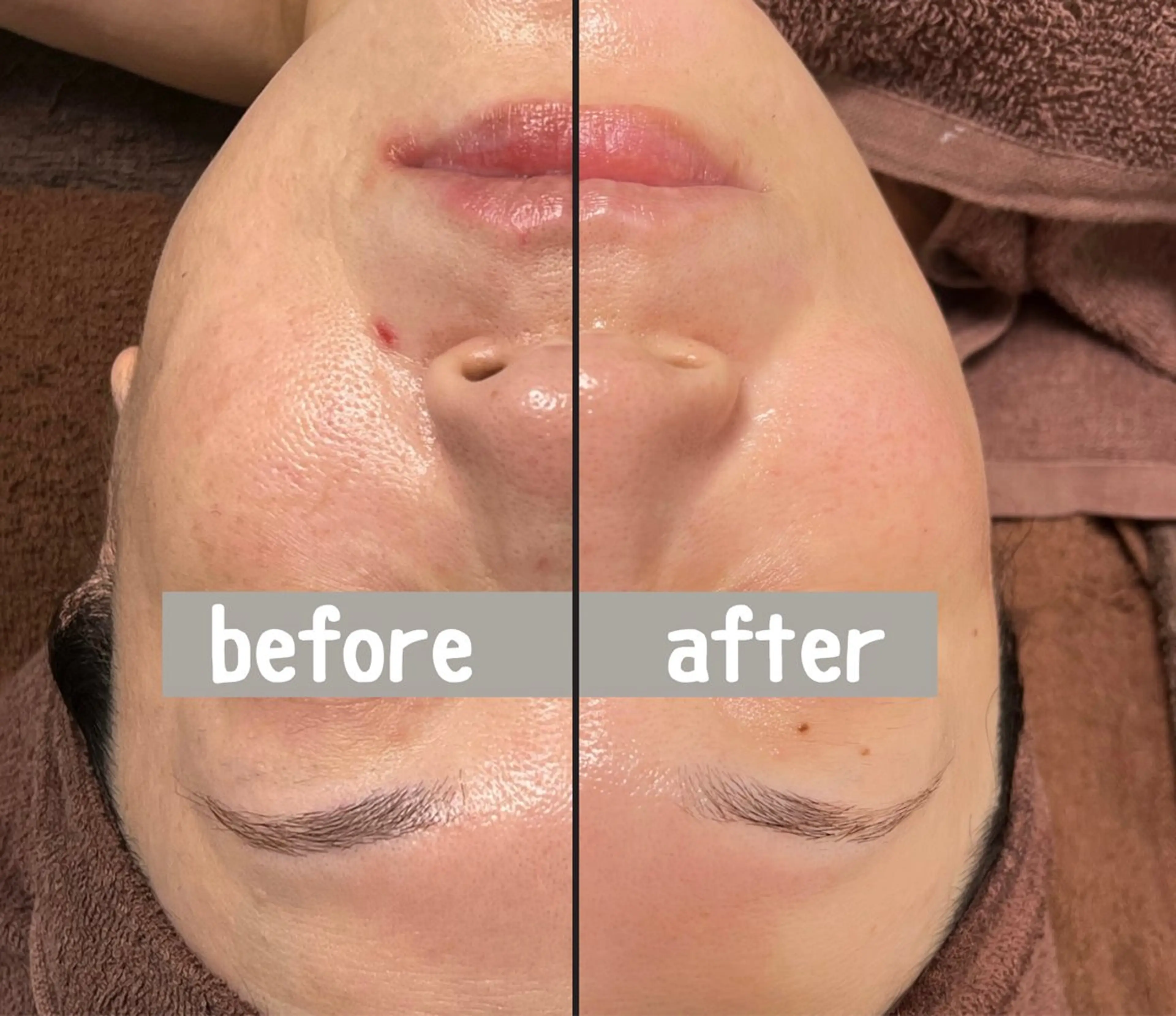 脱毛/毛穴ケア/小顔 博多アンドナイン平尾の眉毛・アイブロウイメージ