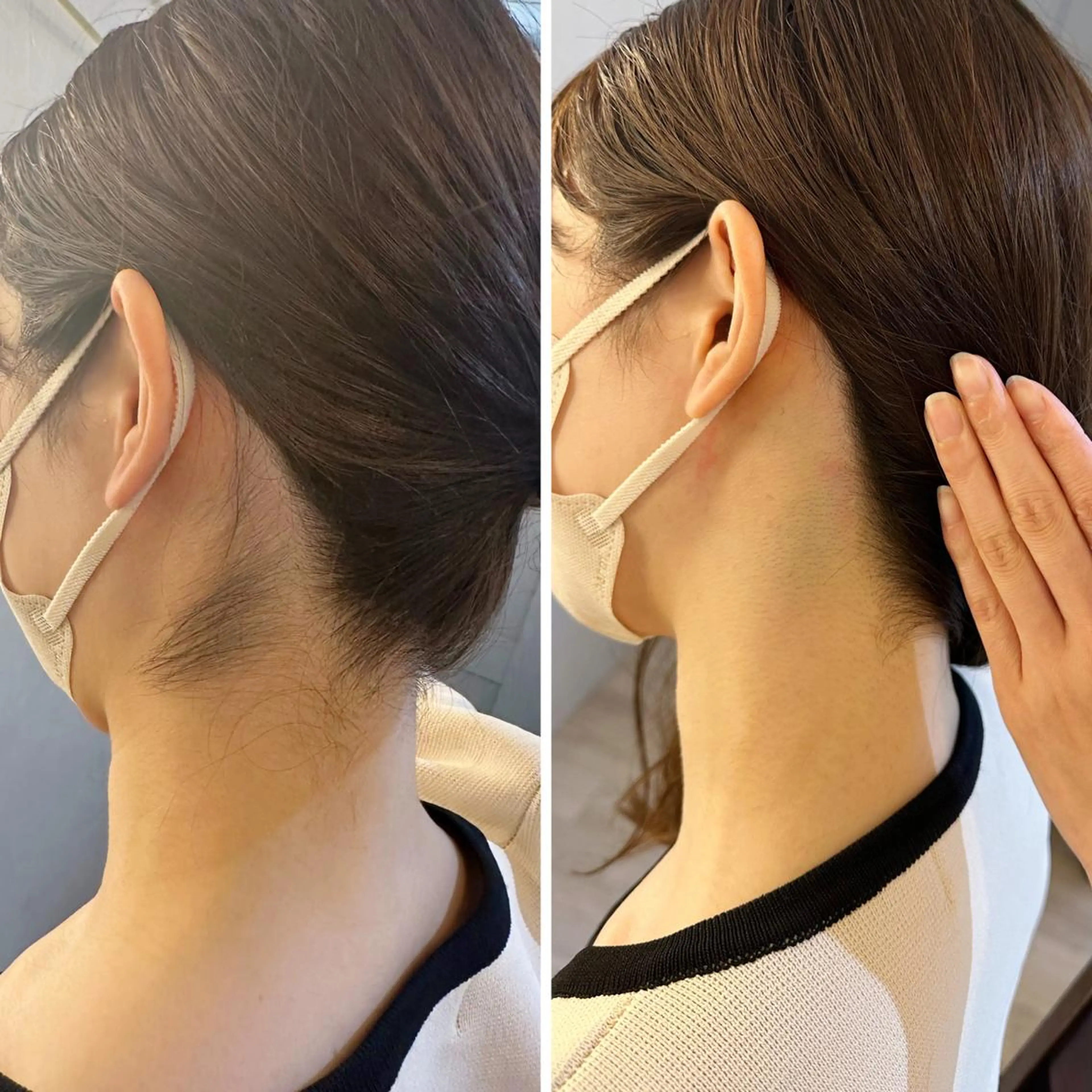 脱毛 うなじ脱毛/美肌脱毛 LABELのエステ・リラクイメージ