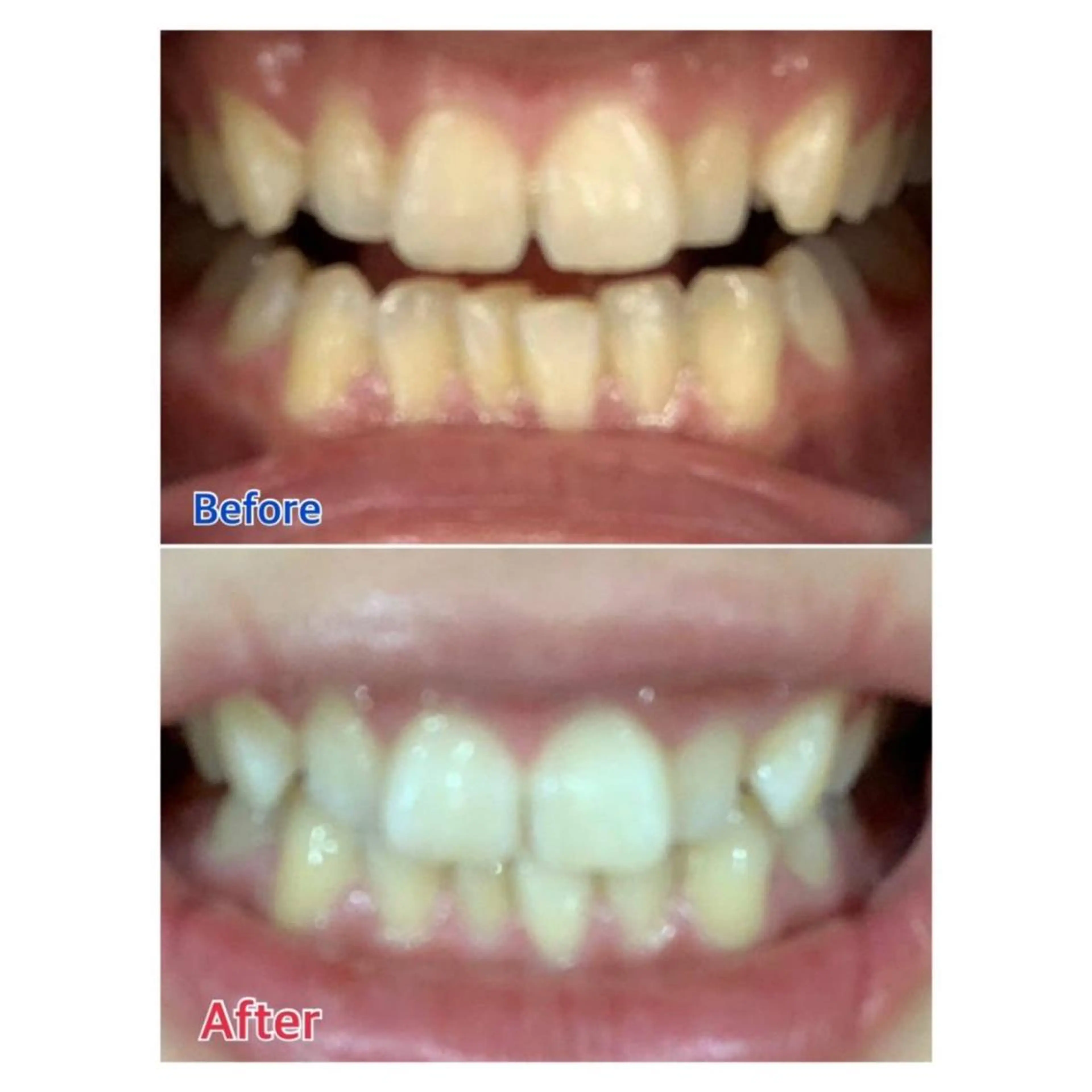 MBEAUTYSALON 千葉店・京成大久保所属・Melty 輝のその他イメージ