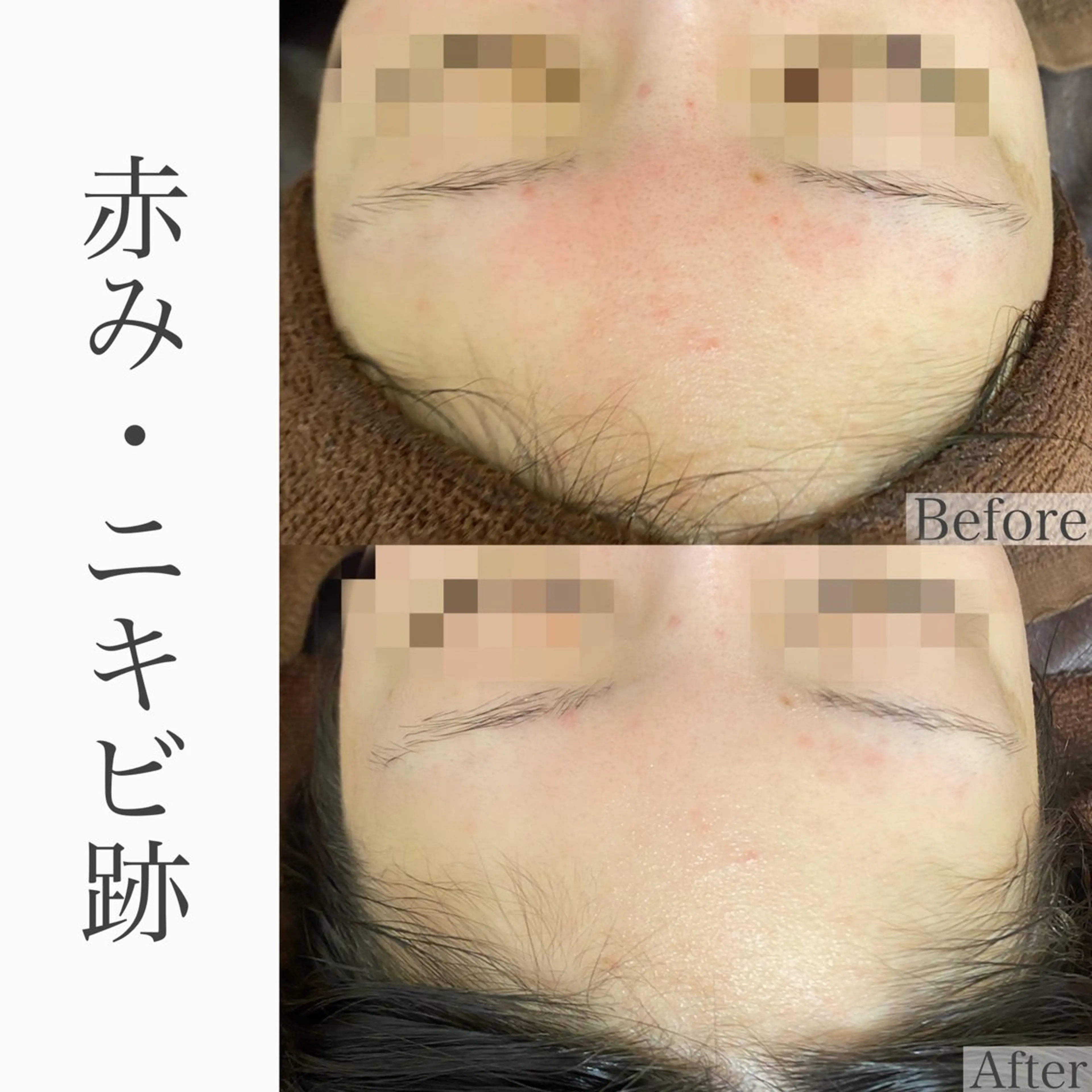 ハーブピーリング専門 BIOEL横浜のエステ・リラクイメージ