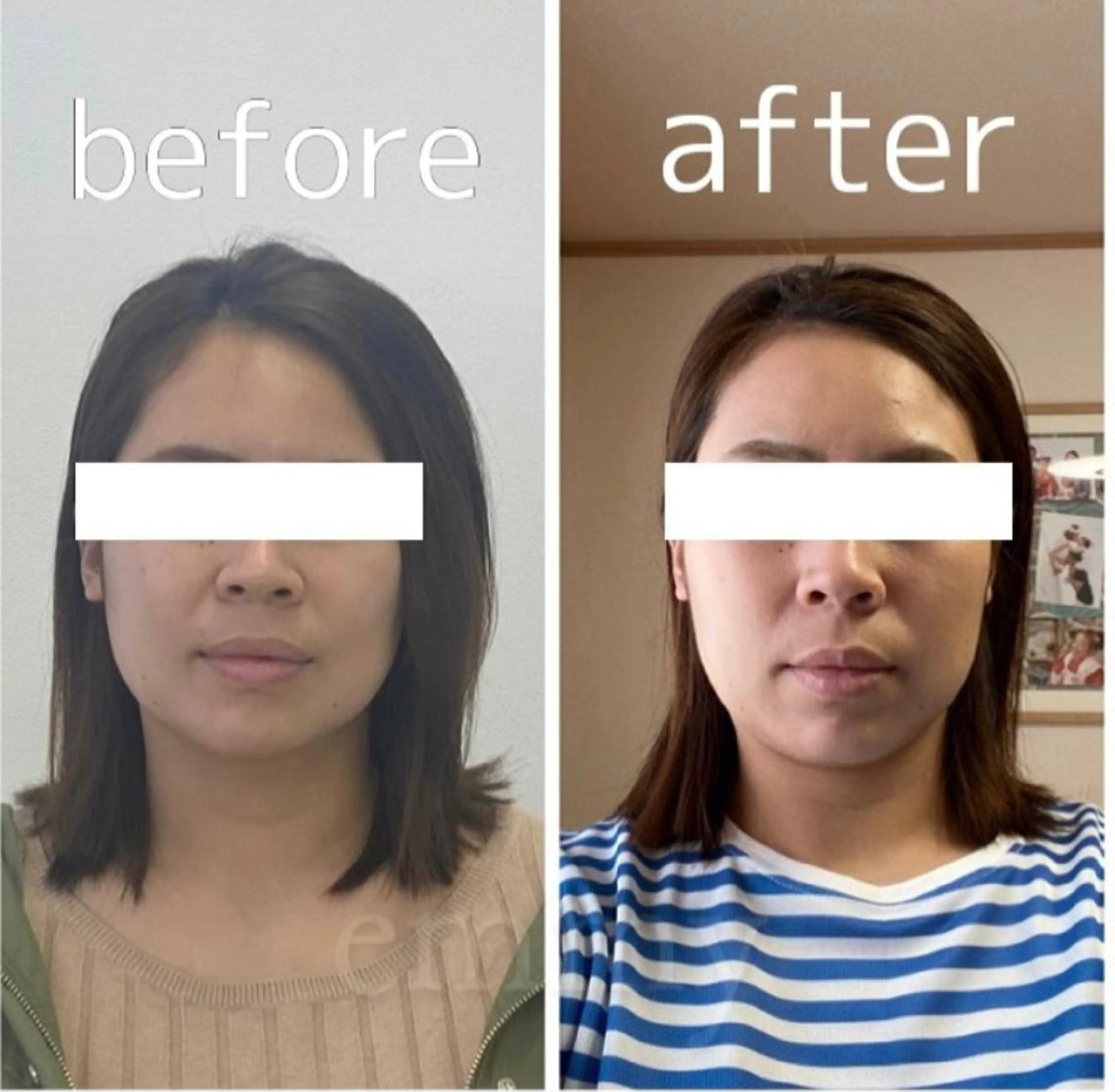 エステ リラク 小顔と ヘッドスパのお店のエステ・リラクイメージ