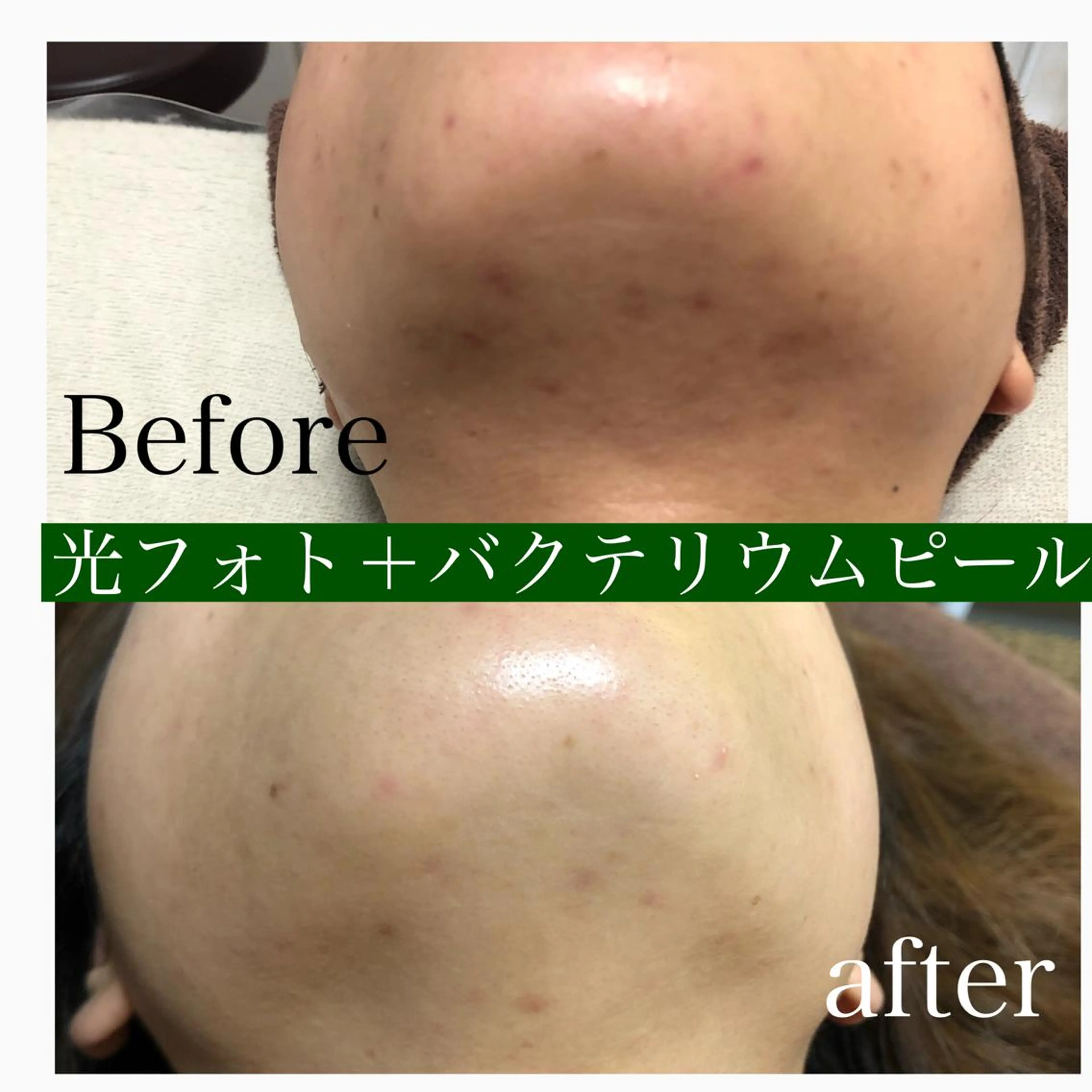 エステ 美肌脱毛と癒しのﾌﾟﾗｲﾍﾞｰﾄｻﾛﾝ。gratia~ｸﾞﾚｲﾃｨｱ~所属・gratia ~ｸﾞﾚｲﾃｨｱ~のエステ・リラクイメージ