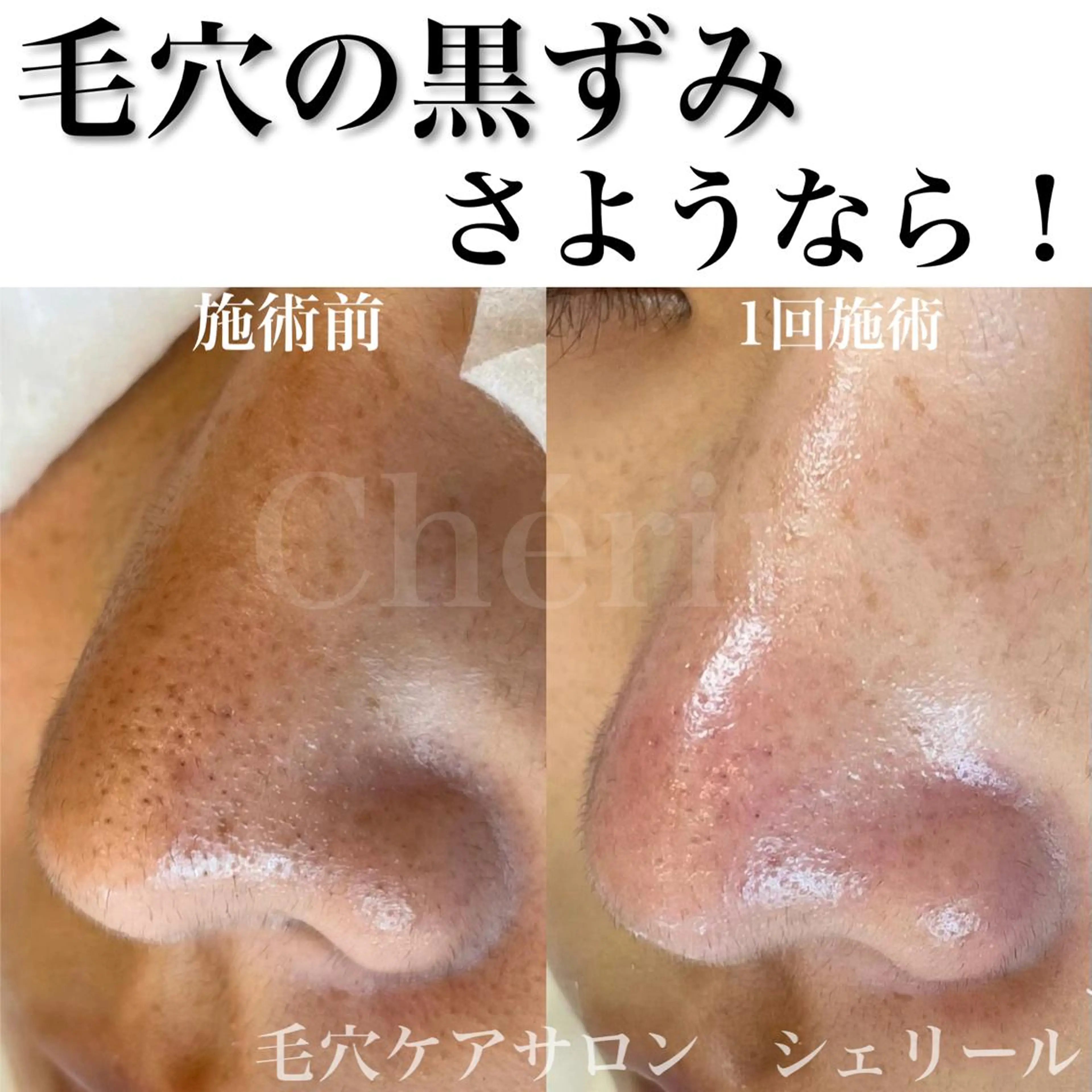 シェリール✳︎ Erinaのマツエク・マツパデザイン