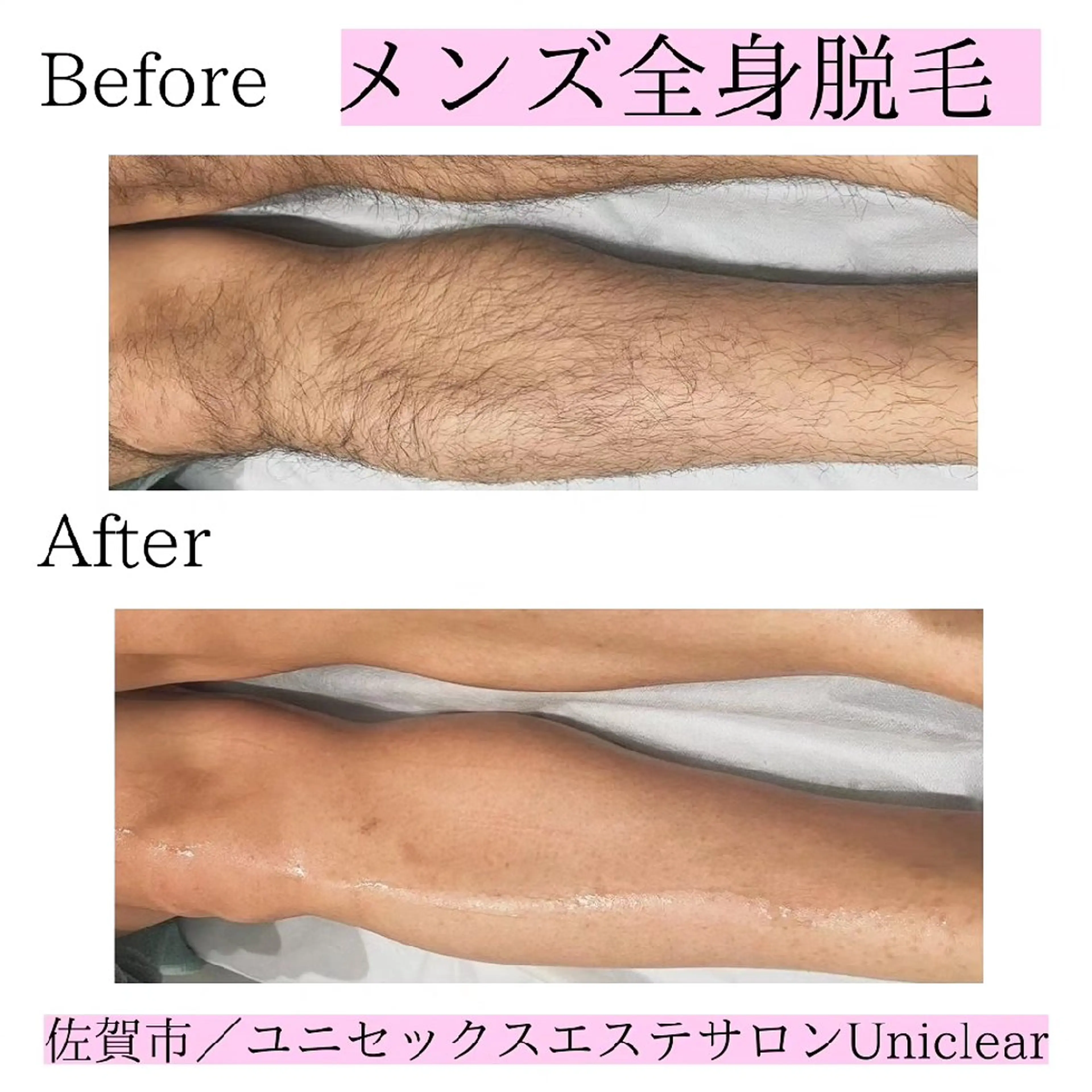 メンズ 脱毛 ユニセックスエステサロンUniclear所属・男女エステユニクリア Uniclearのエステ・リラクイメージ