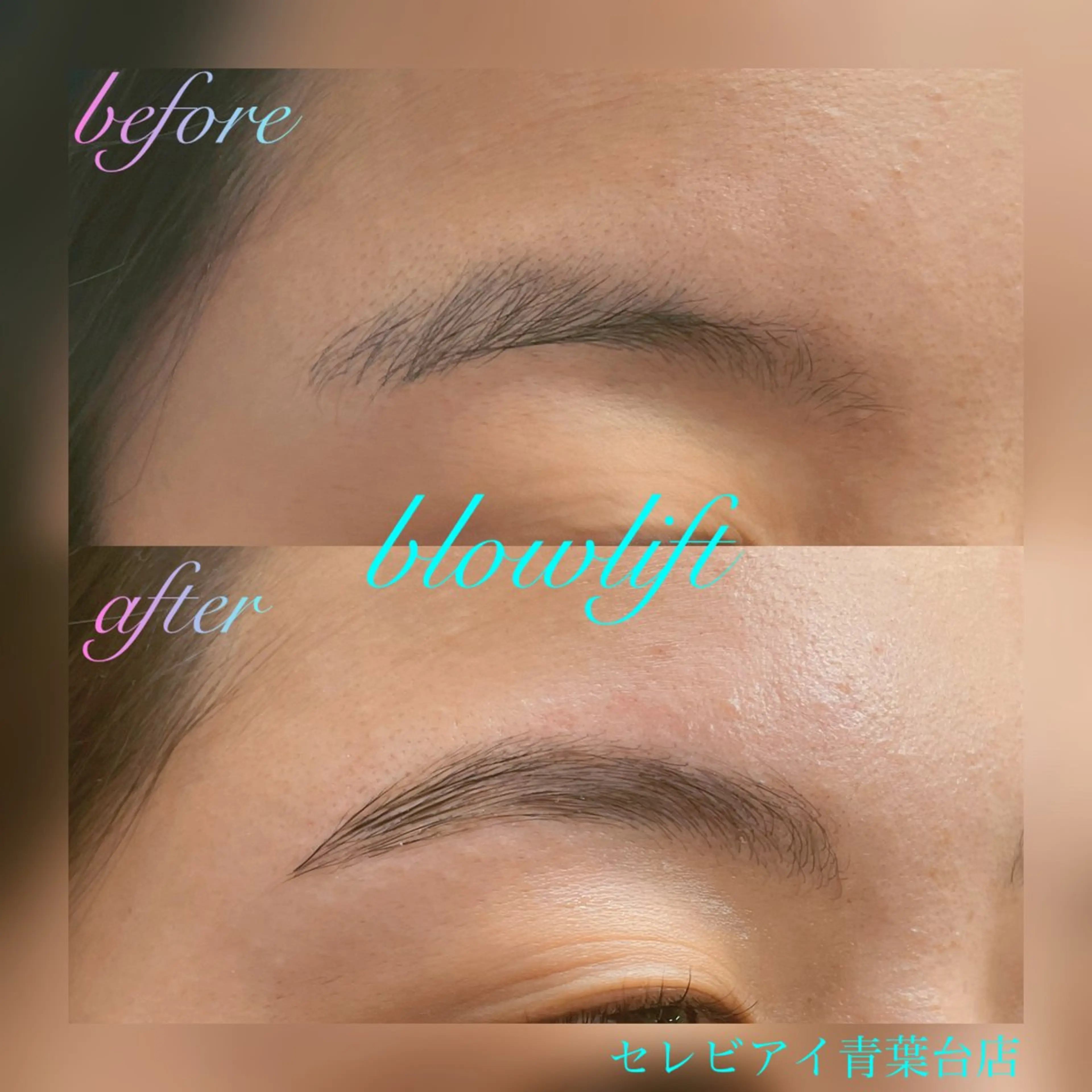 ブロウリフト+WAX脱毛🍓の写真