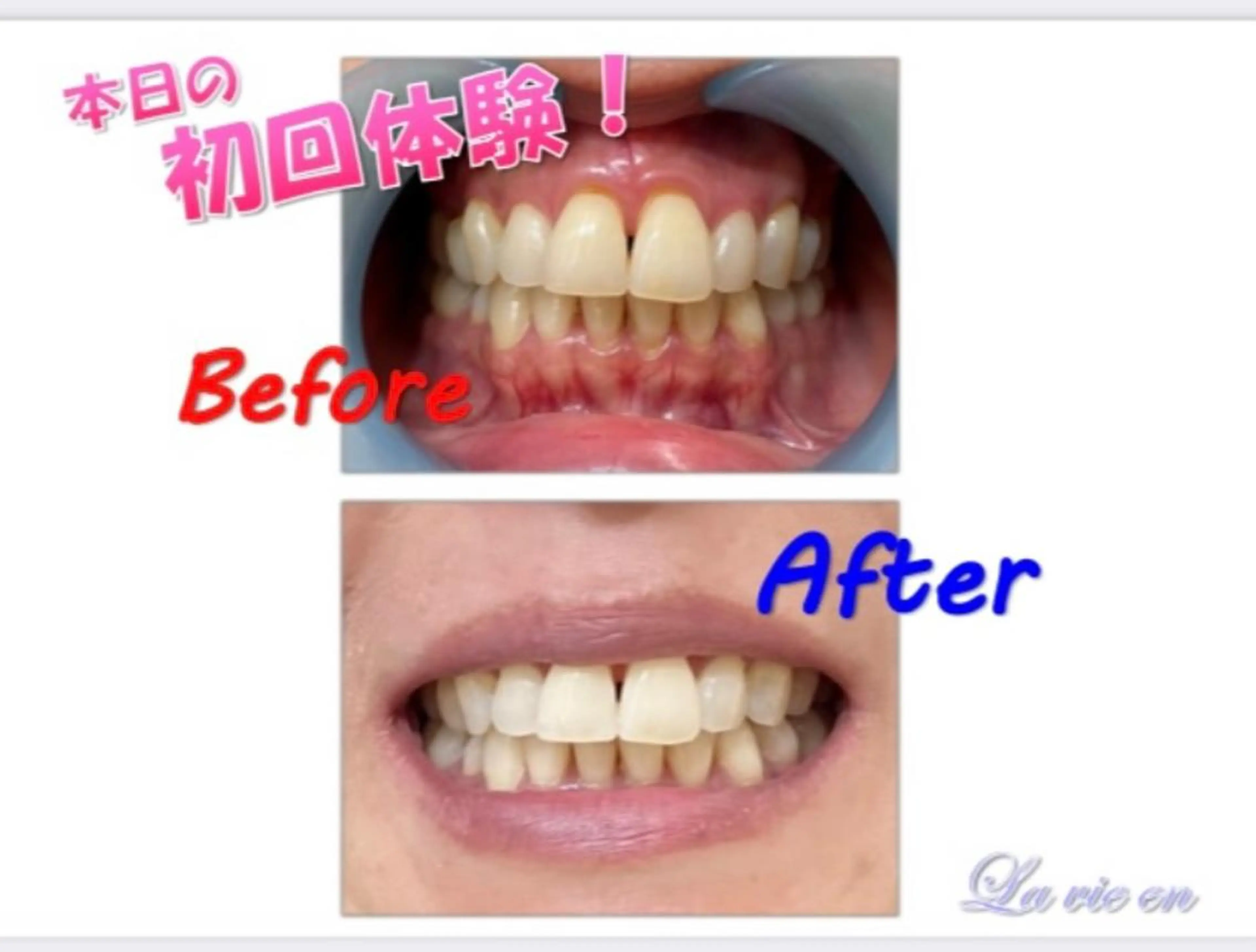 その他 セルフホワイトニングサロン　ラヴィアン所属・ホワイトニングサロン La vie enのその他イメージ