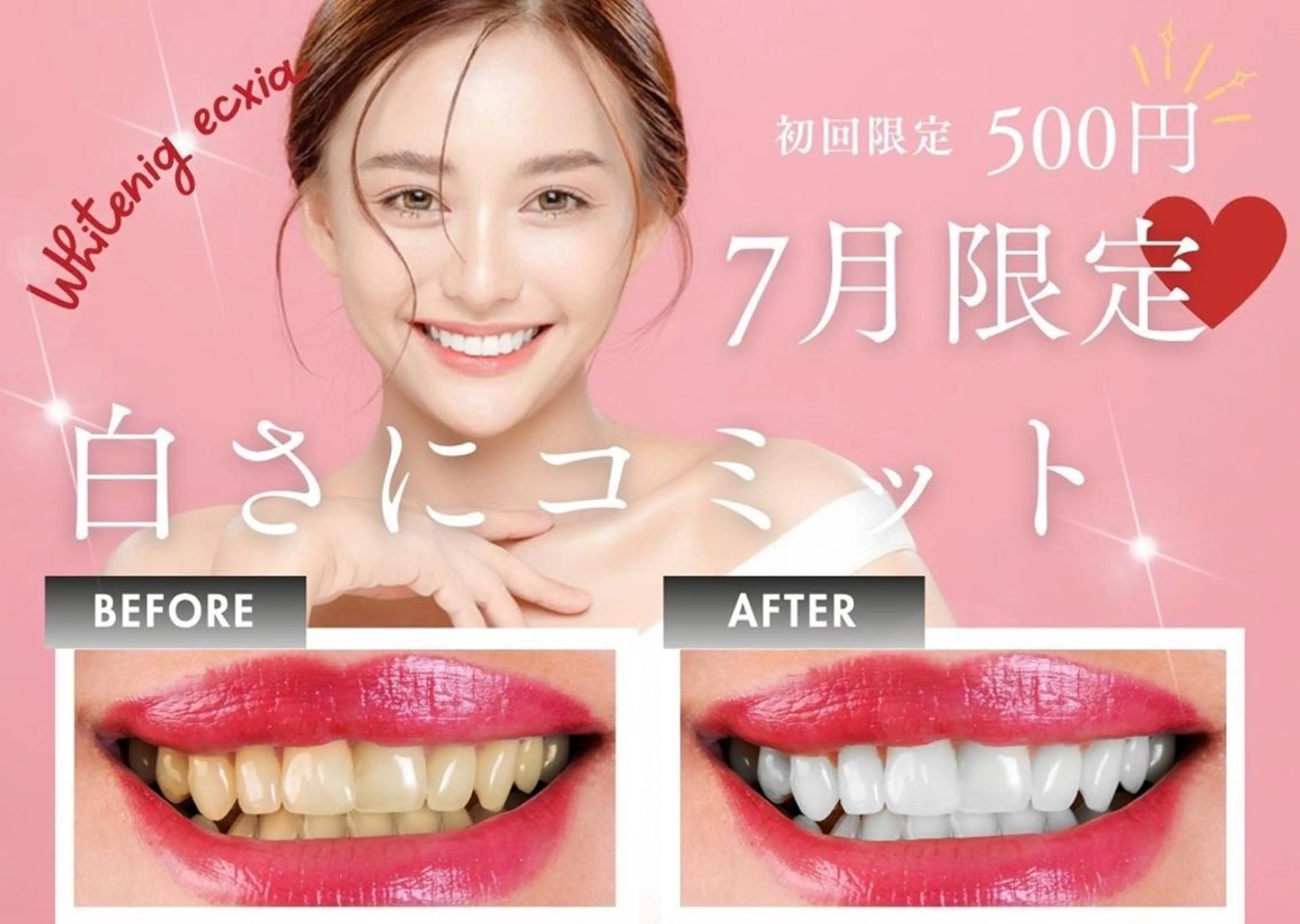 その他 セルフホワイトニング エクシア沖縄宮里店のその他イメージ