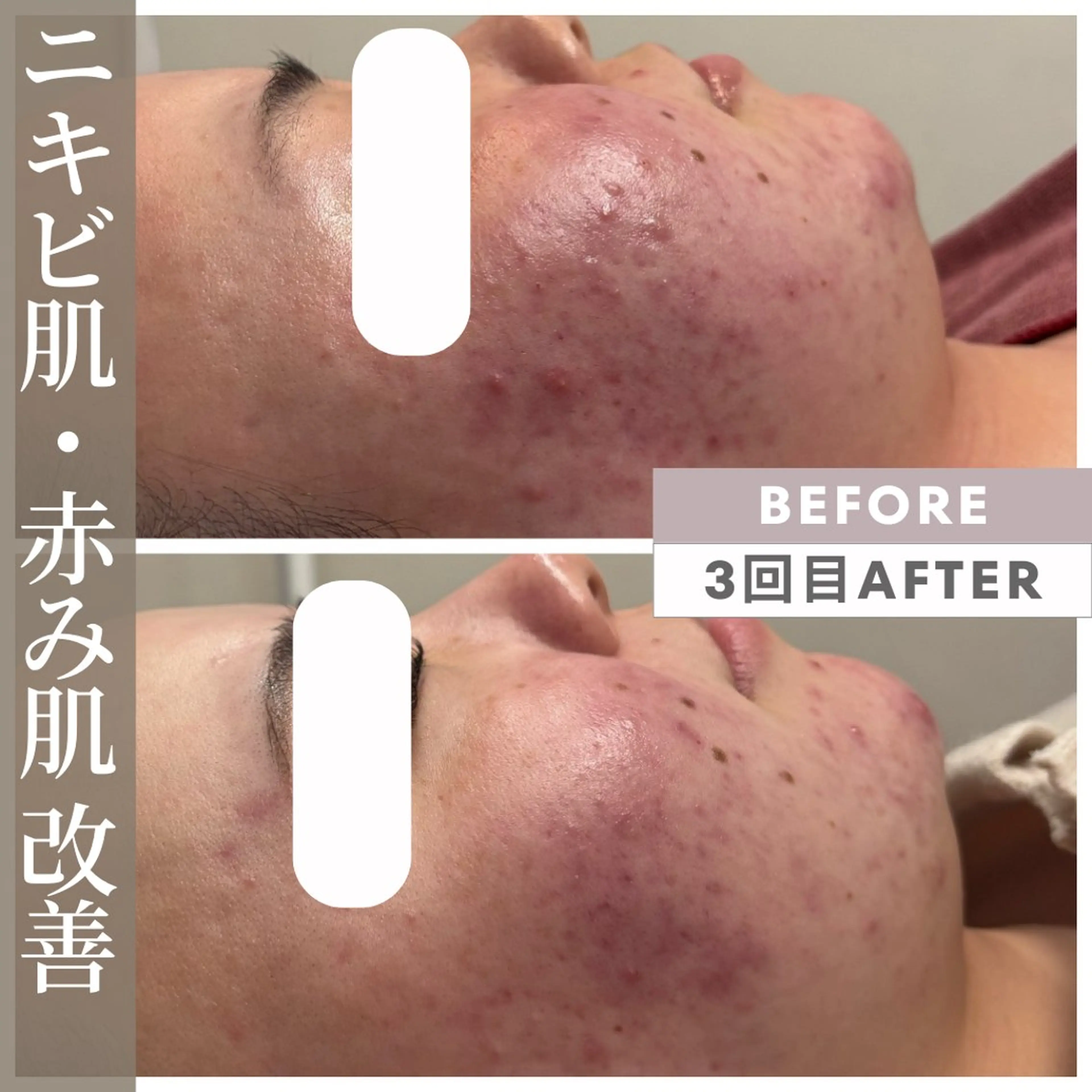 エステ 小顔矯正専門店 【RED】池田のエステ・リラクイメージ