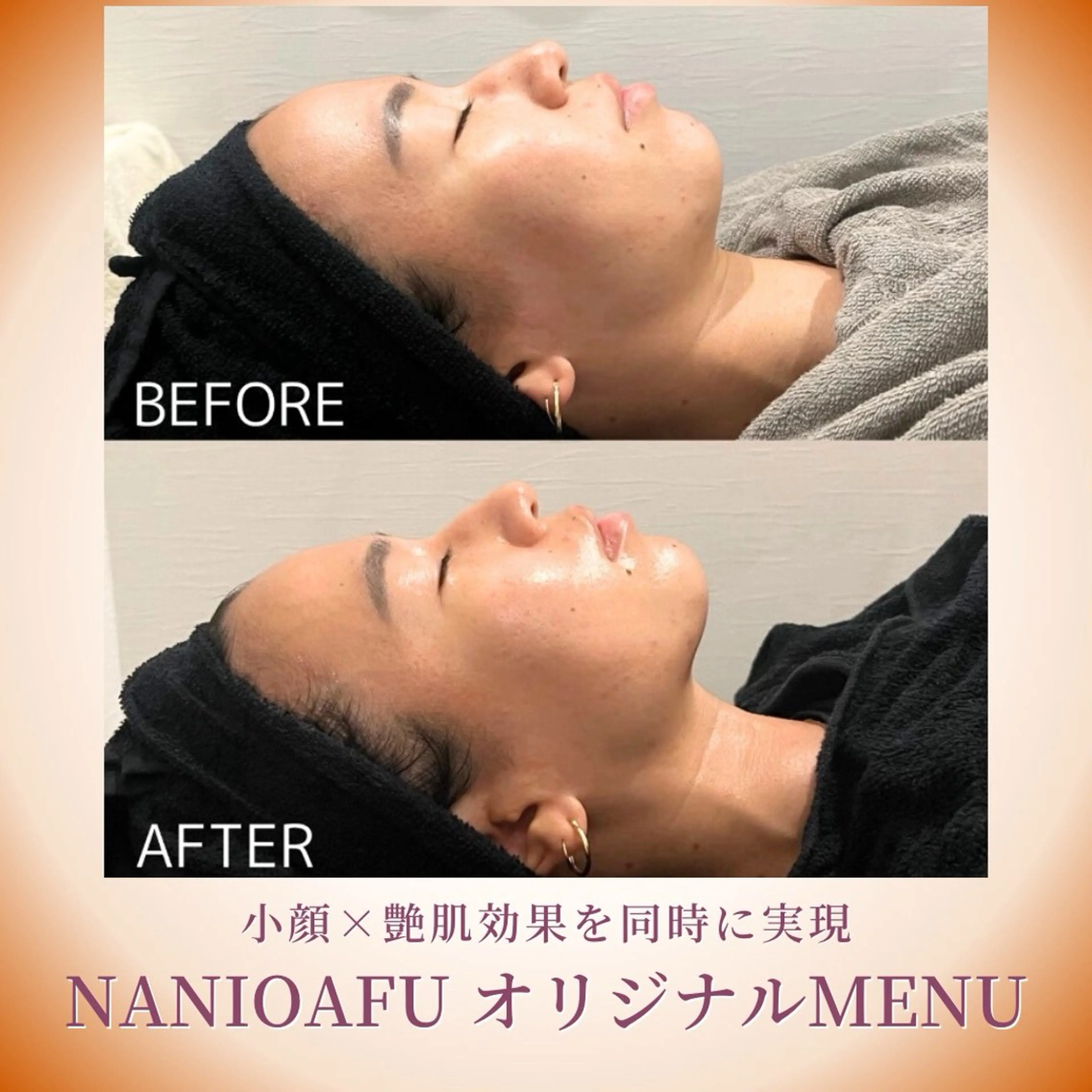 その他 NANI OAFU所属・NANIOAFU [なんば店］のエステ・リラクイメージ