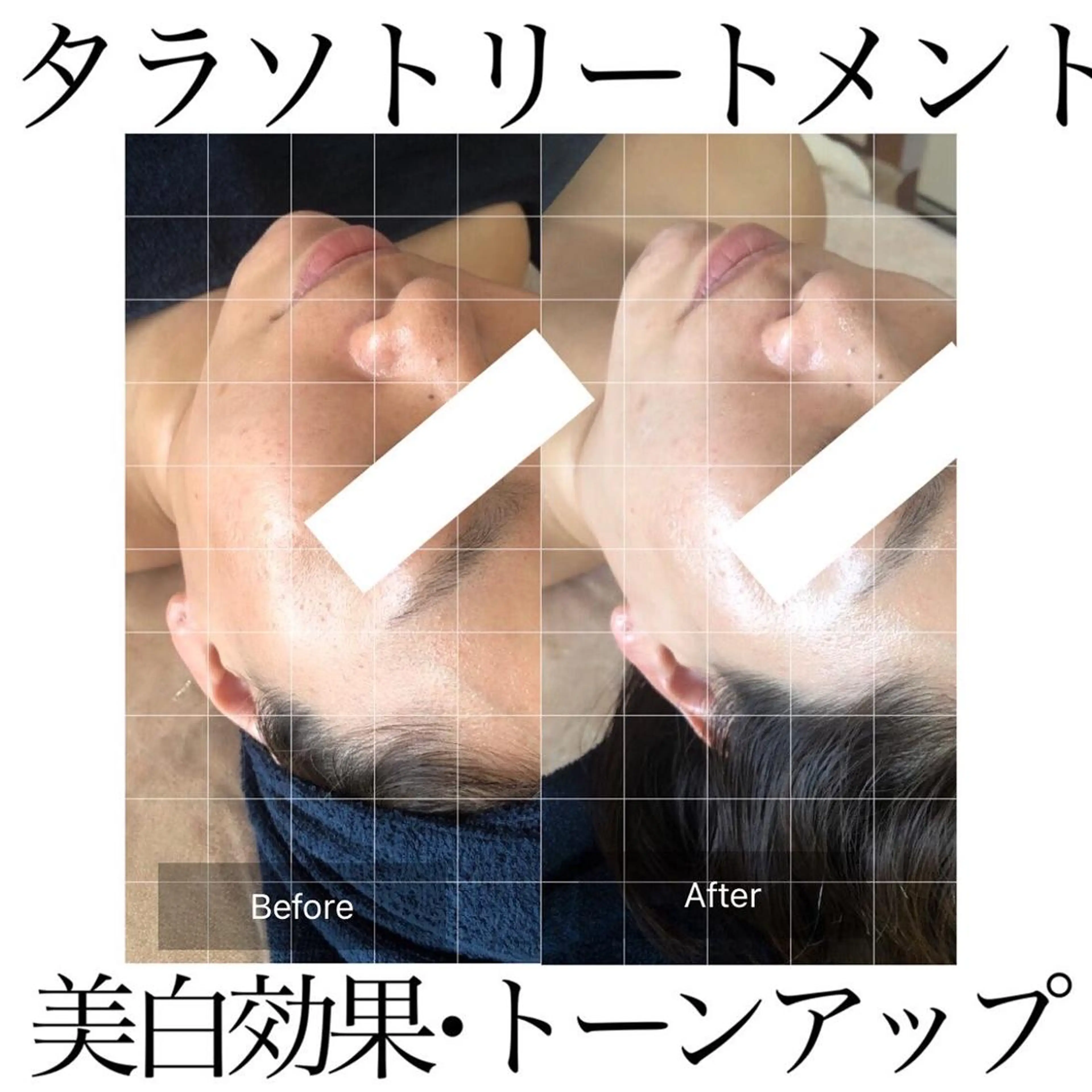 エステ Fleur beauty salon所属・Fleur 児玉聖子のエステ・リラクイメージ