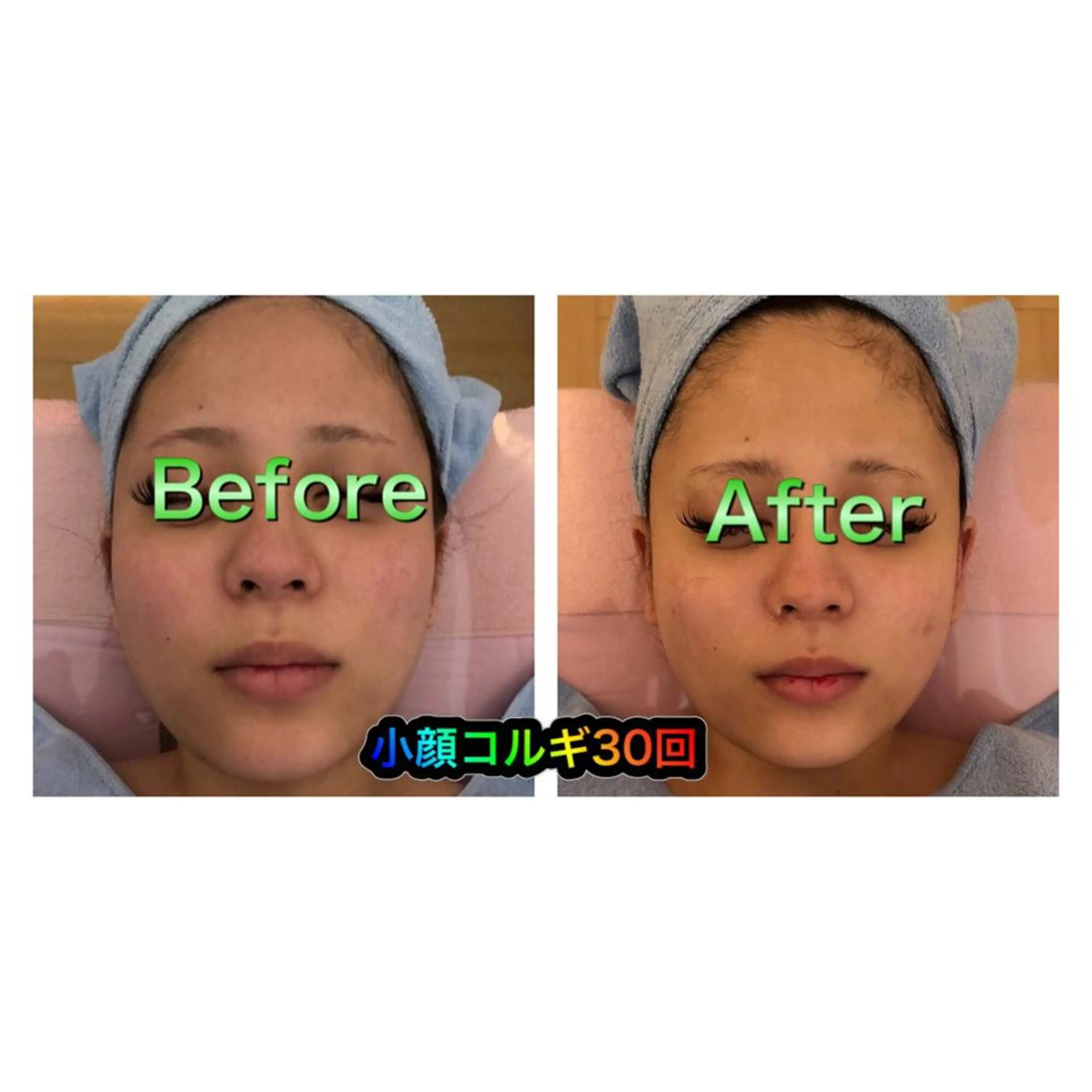 【ハイパーナイフ痩身&小顔コルギ&ハーブピーリング】K-Beauty　東新宿所属・kーbeauty痩身 フェイシャルのエステ・リラクイメージ