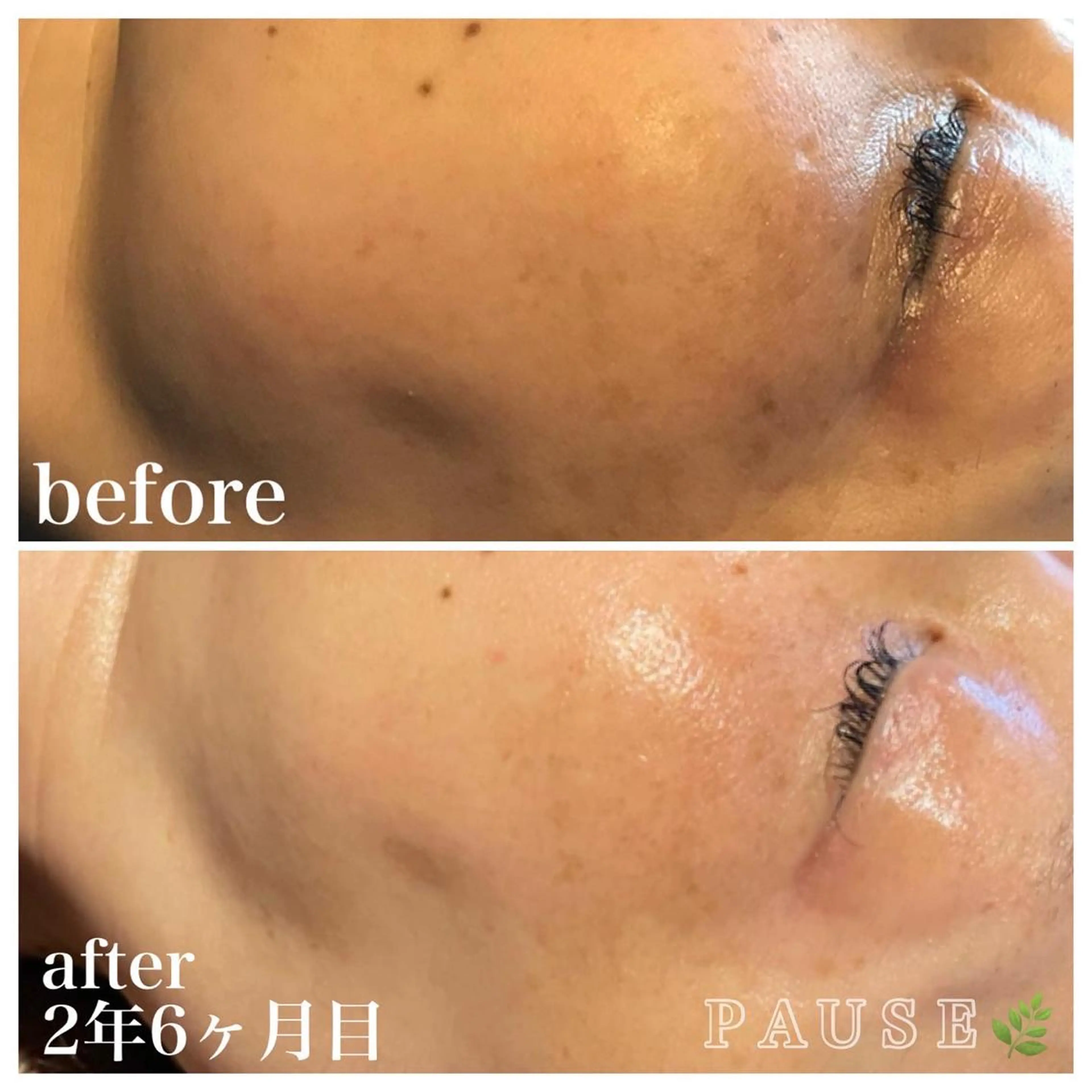 エステ 浜野 恵美のエステ・リラクイメージ