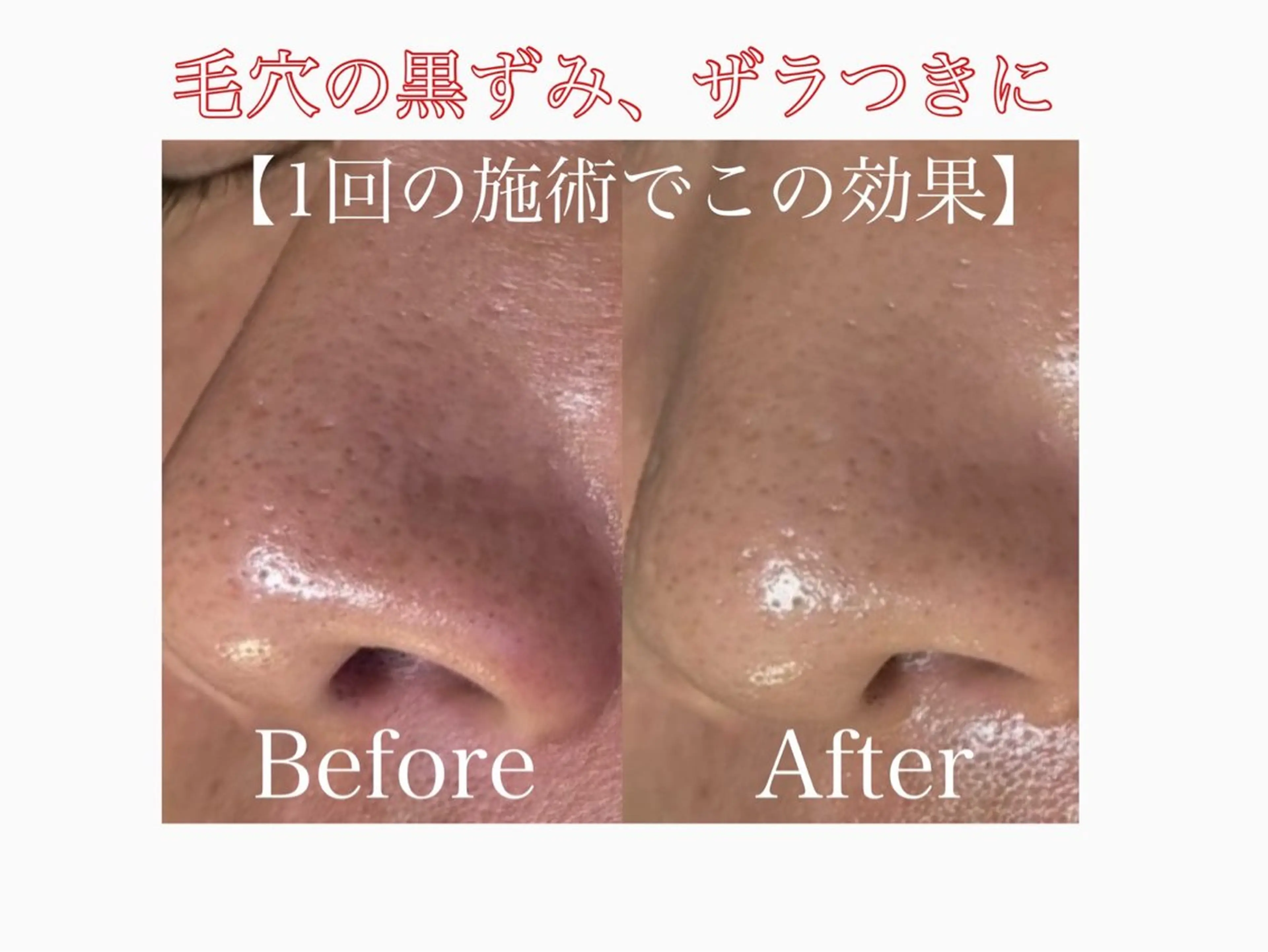 エステ 🌸🧡六本木 脱毛しずか🧡🫧の眉毛・アイブロウイメージ