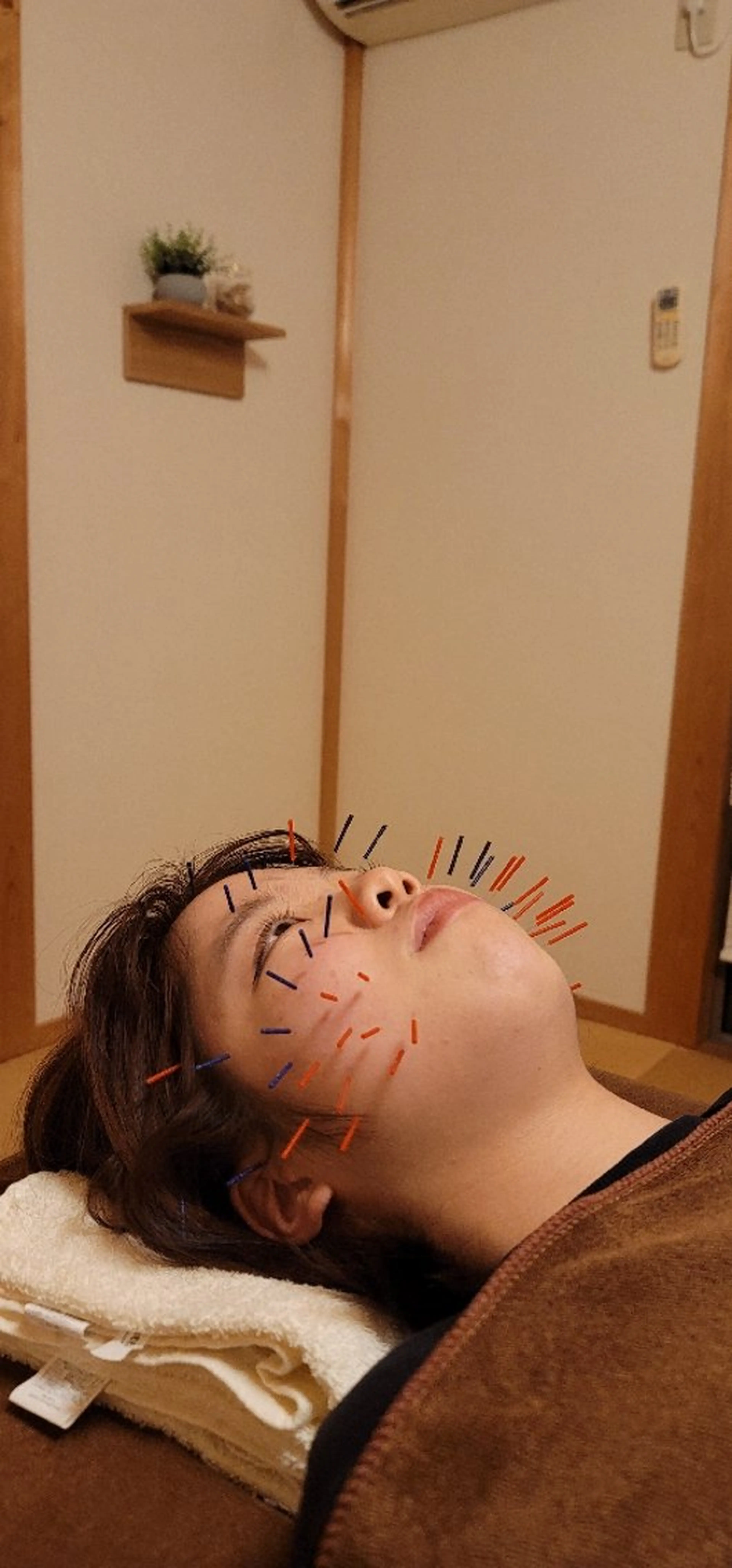 リラク なかむら鍼灸院所属・なかむら 鍼灸院のエステ・リラクイメージ