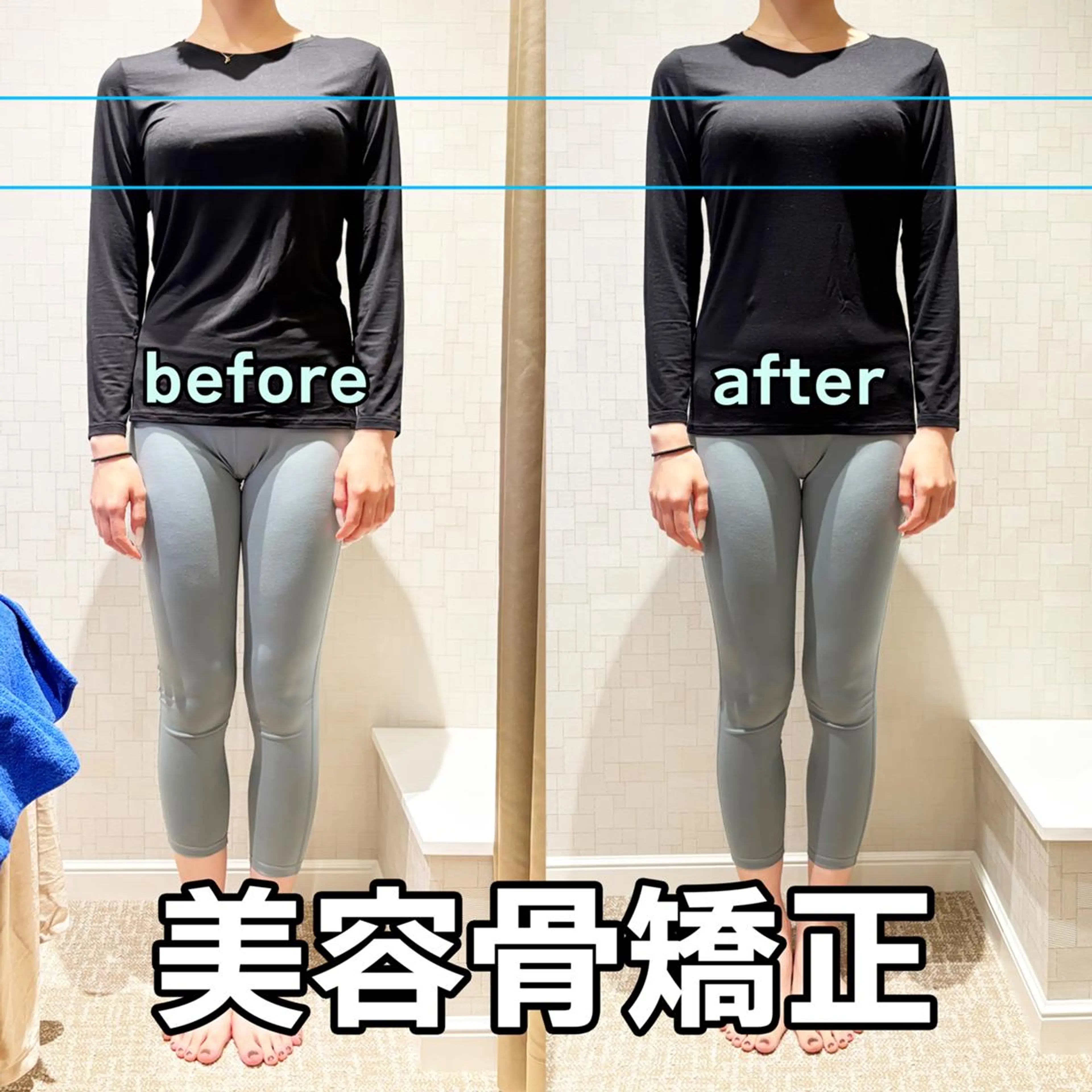 美容骨矯正☆肩こり・腰痛・不調改善×見た目変化◎の写真