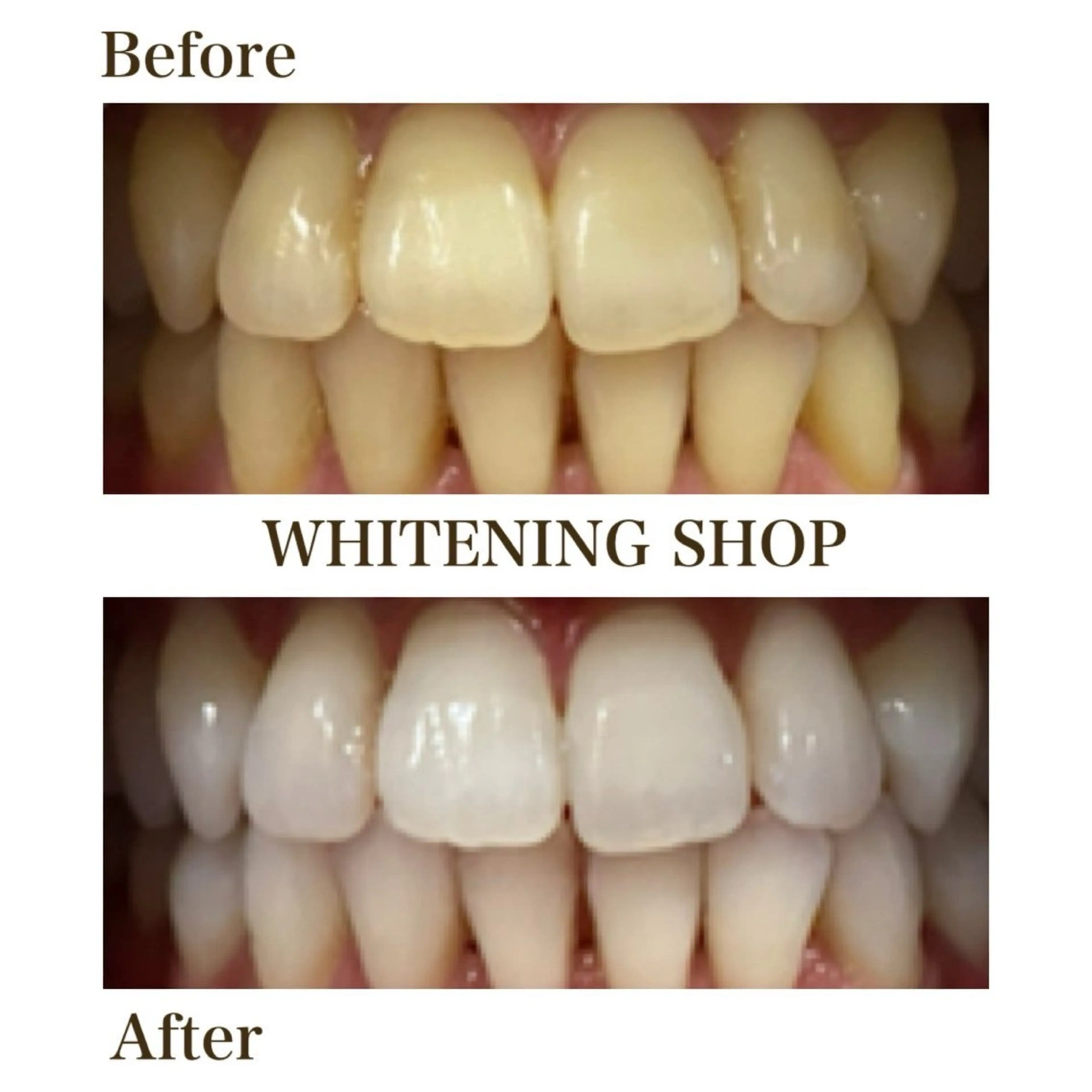 セルフホワイトニングショップ静岡葵区店所属・もえか静岡葵区店ホ ワイトニングショップのその他イメージ