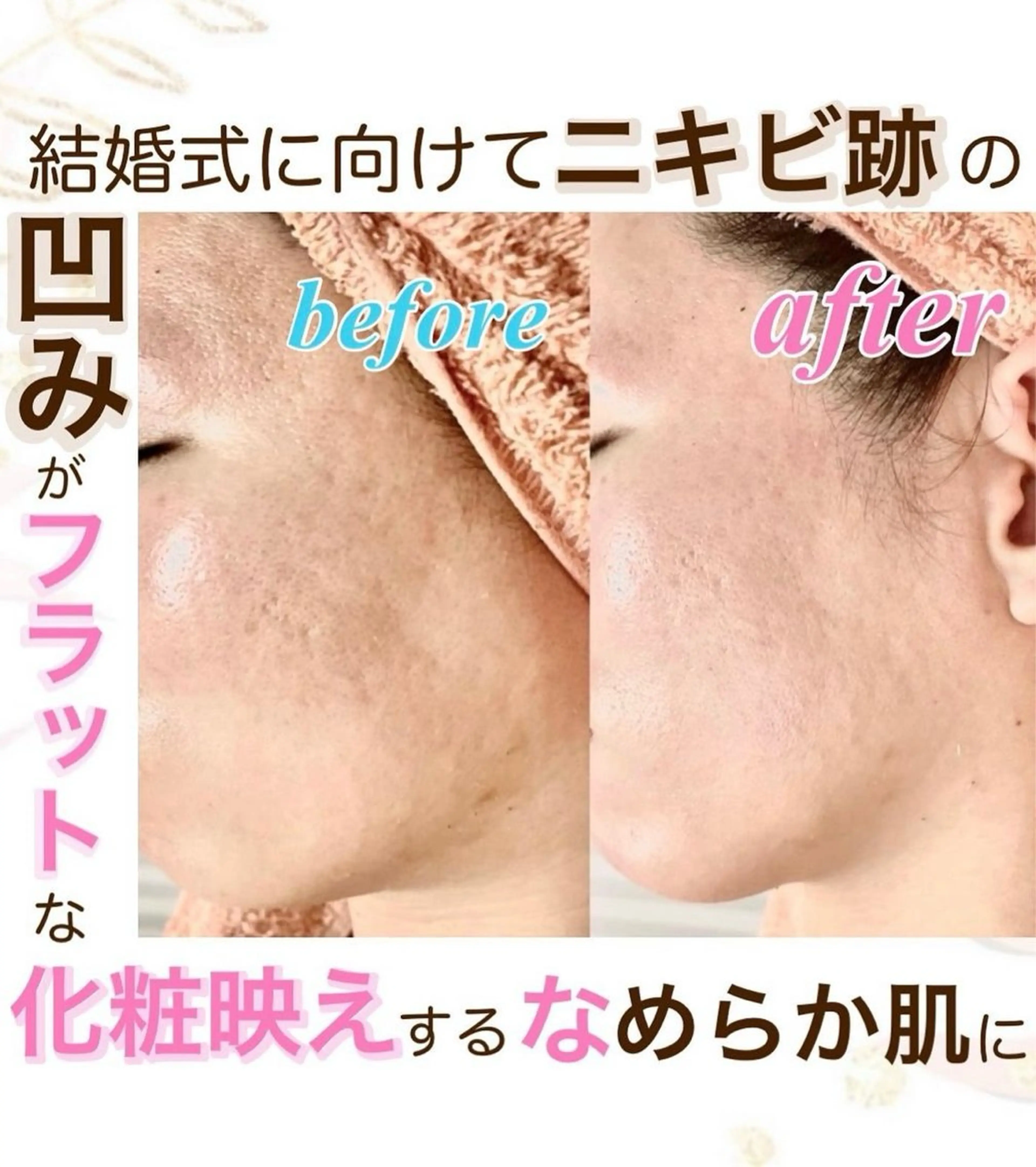 エステ オーダーメイドエステ　ソワンドビジュー所属・美肌×小顔専門/ 亀澤いずみのエステ・リラクイメージ