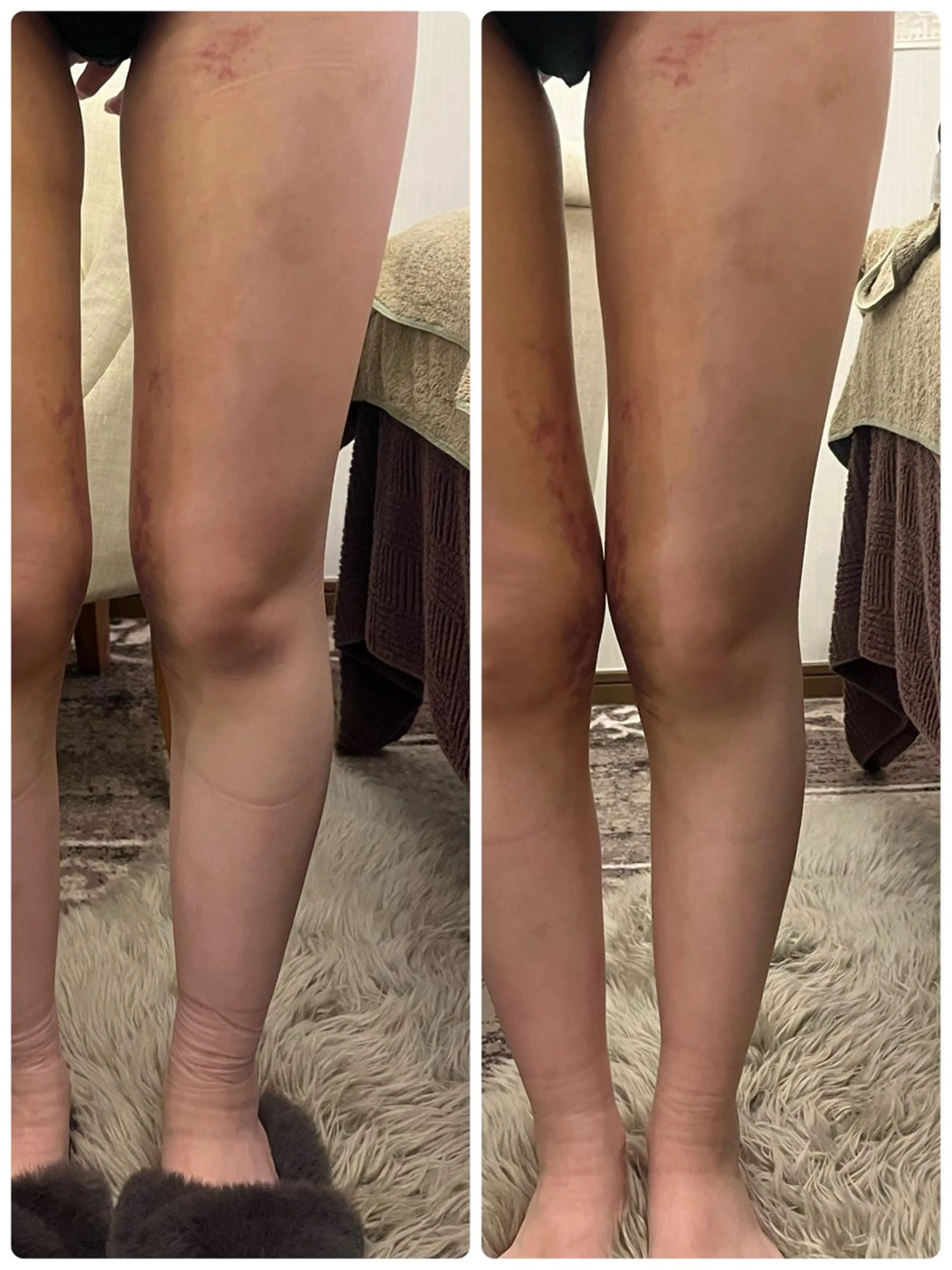 エステ 深部加温に特化した ブレッシングのその他イメージ