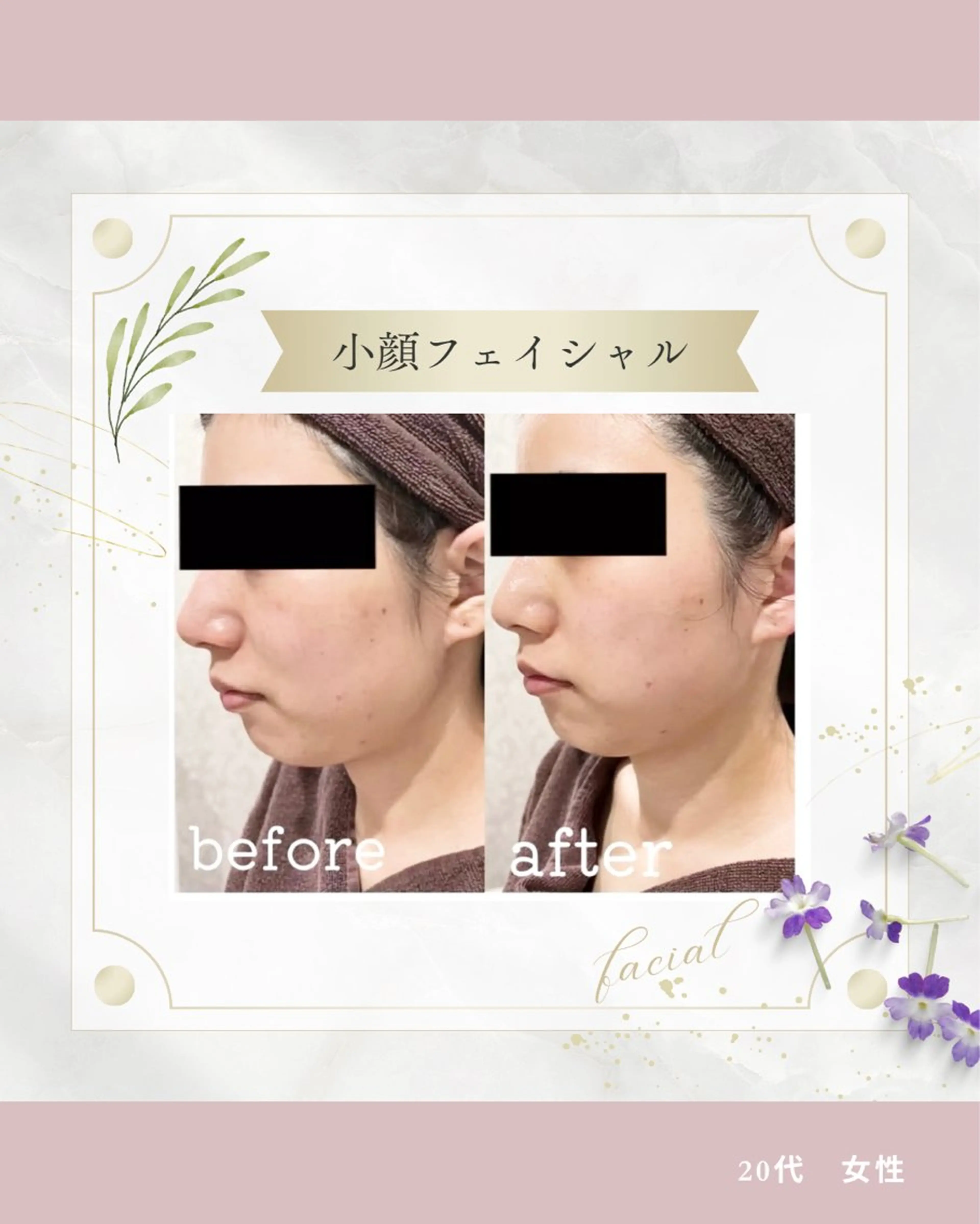 《 肌質改善 》 addissimoのエステ・リラクイメージ