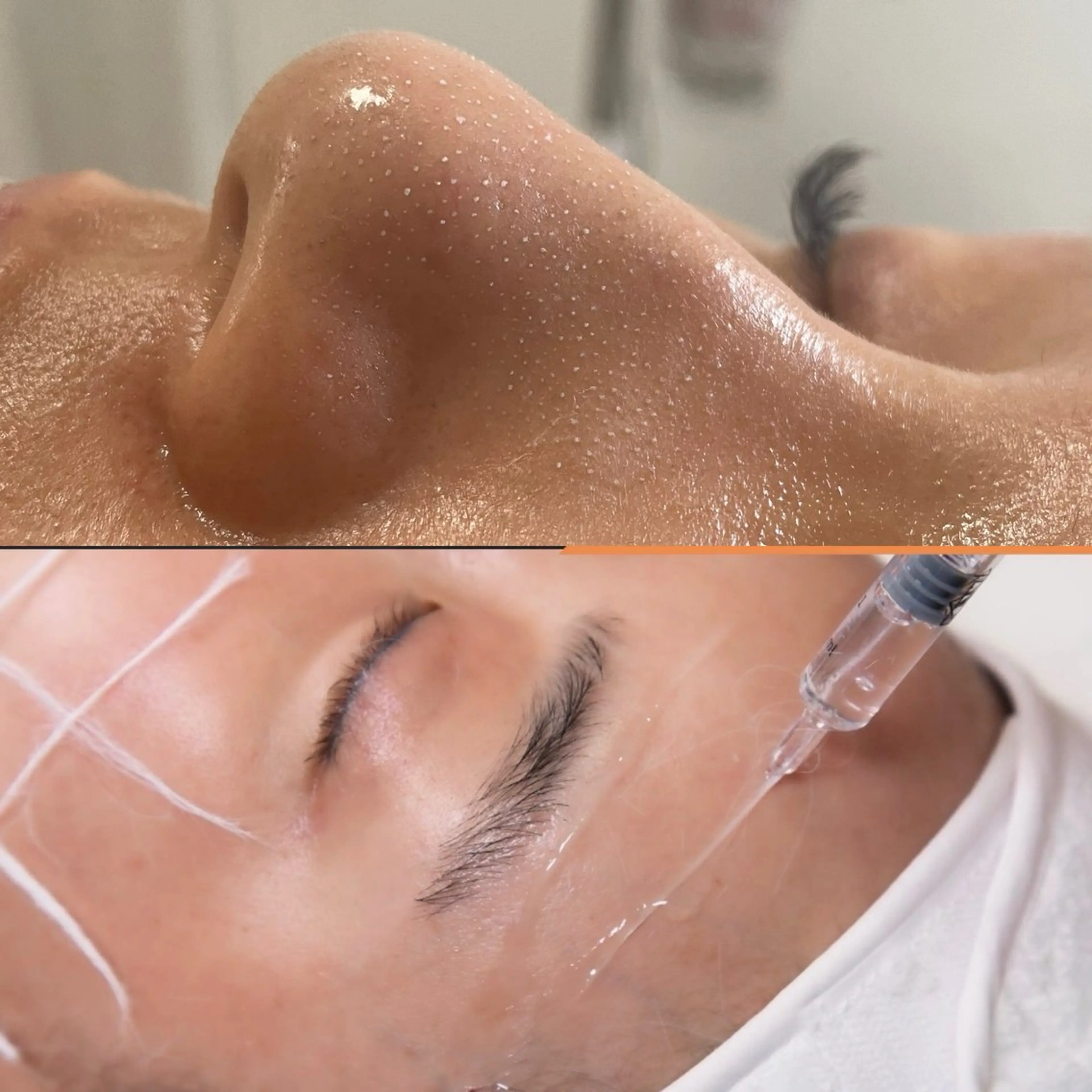 【リフトアップしてとことんツルツルにしたい✨】水素ハイドラ＋溶ける糸コラーゲン爆誕セラム🫶🏻✨の写真