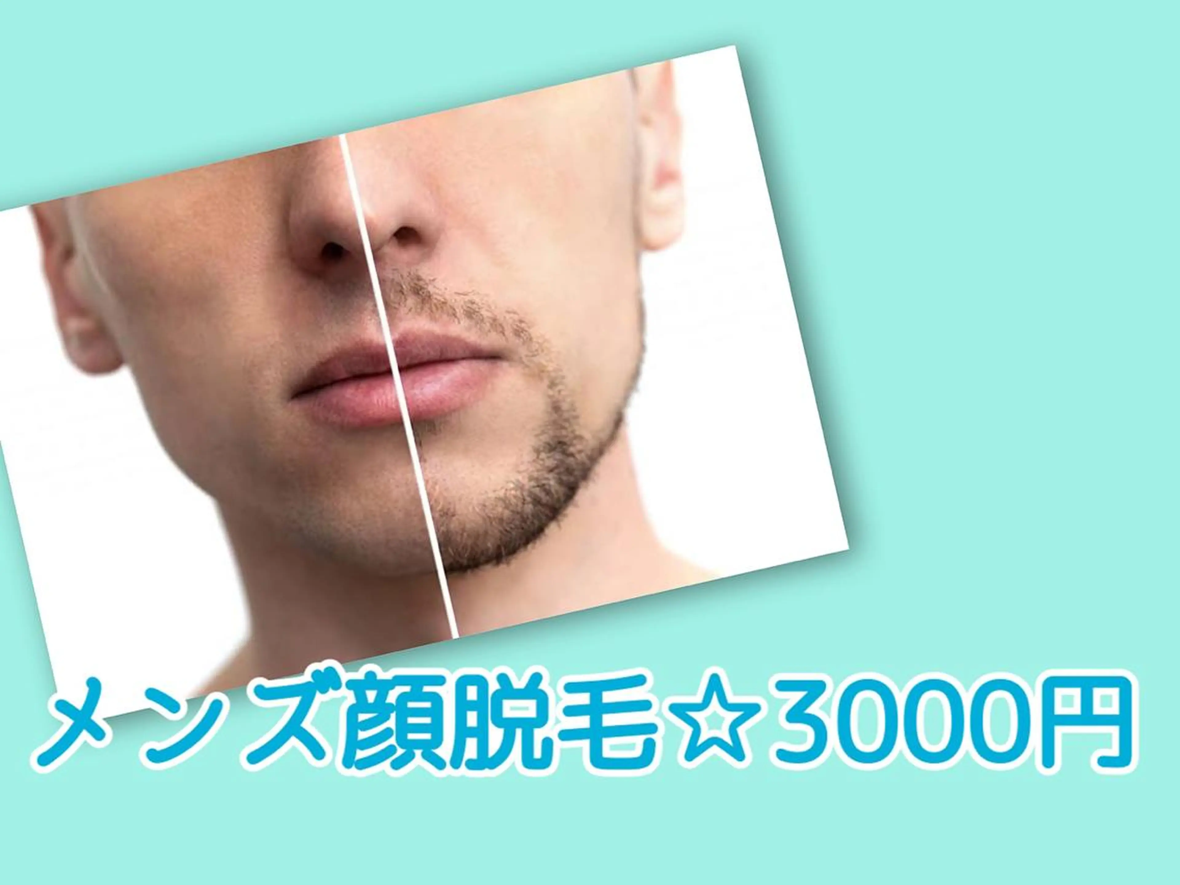 メンズ 脱毛 都度払い脱毛⭐️ 脱毛サロンMIRACのエステ・リラクイメージ