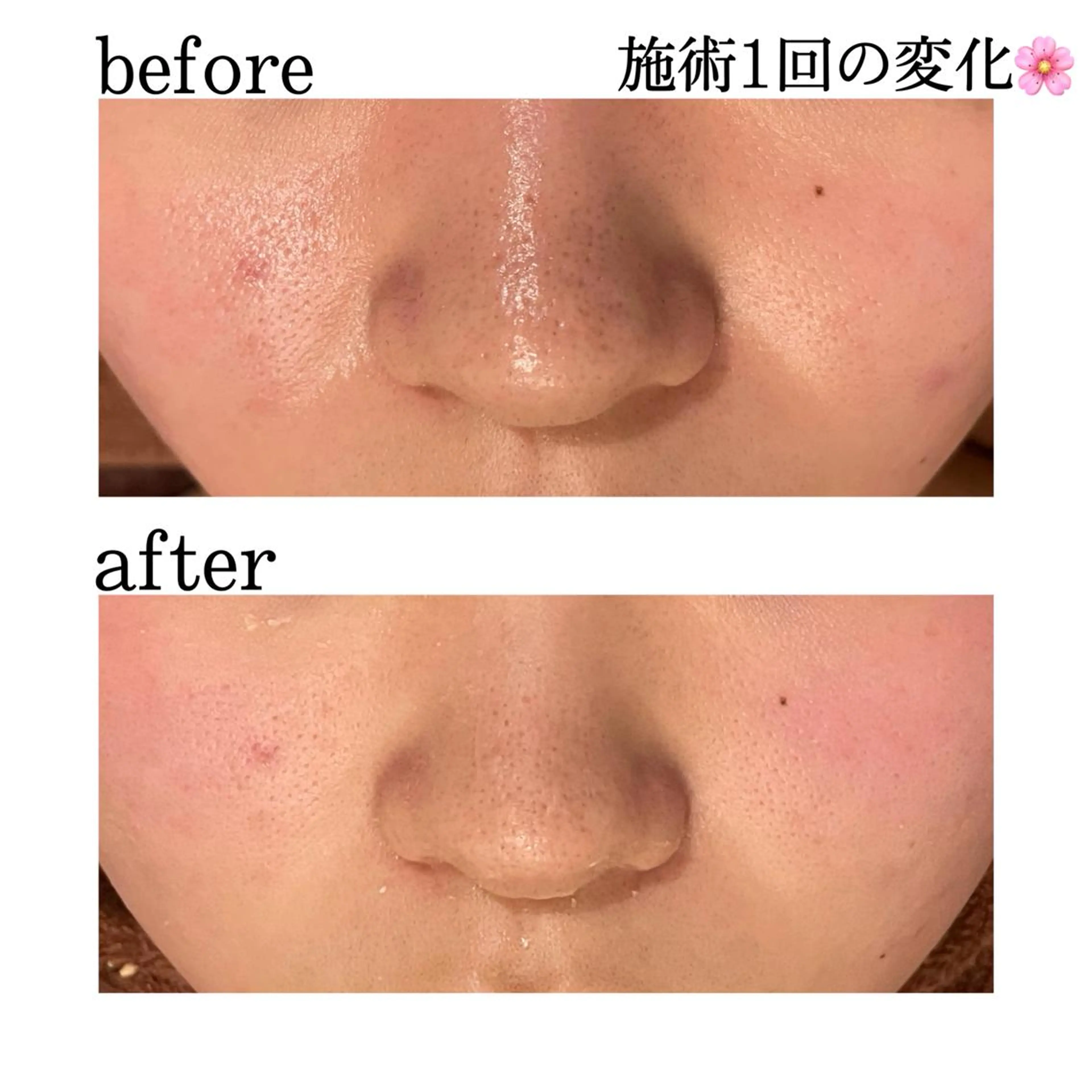 触れたくなる モテ肌へ...❤︎のエステ・リラクイメージ